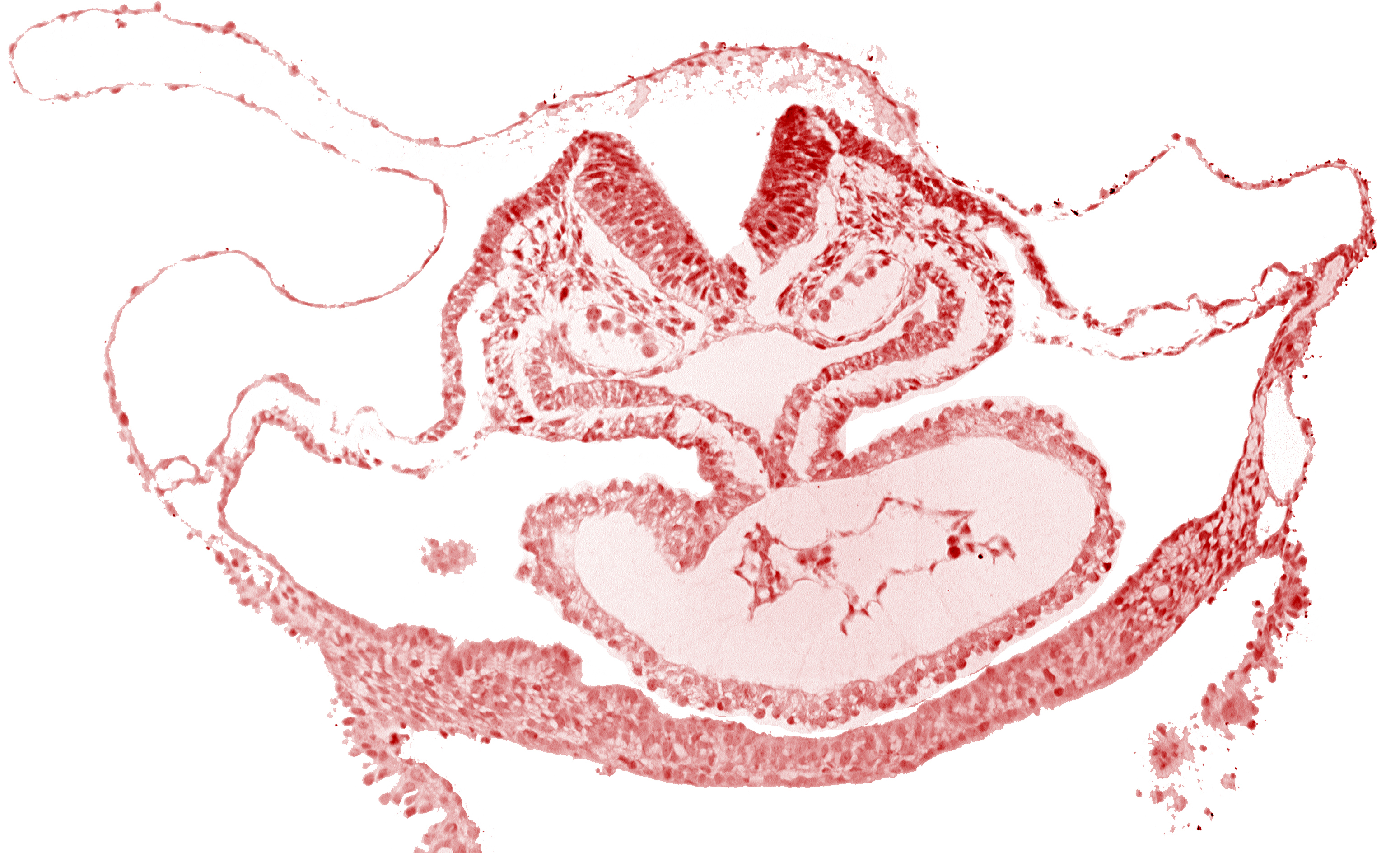 atrial canal, cardiac jelly, cephalic neuropore, dorsal aorta, edge of presumptive left atrium, foregut endoderm, foregut lumen, neural fold [rhombencephalon (Rh. C)], otic placode, pericardial cavity, presumptive left ventricle