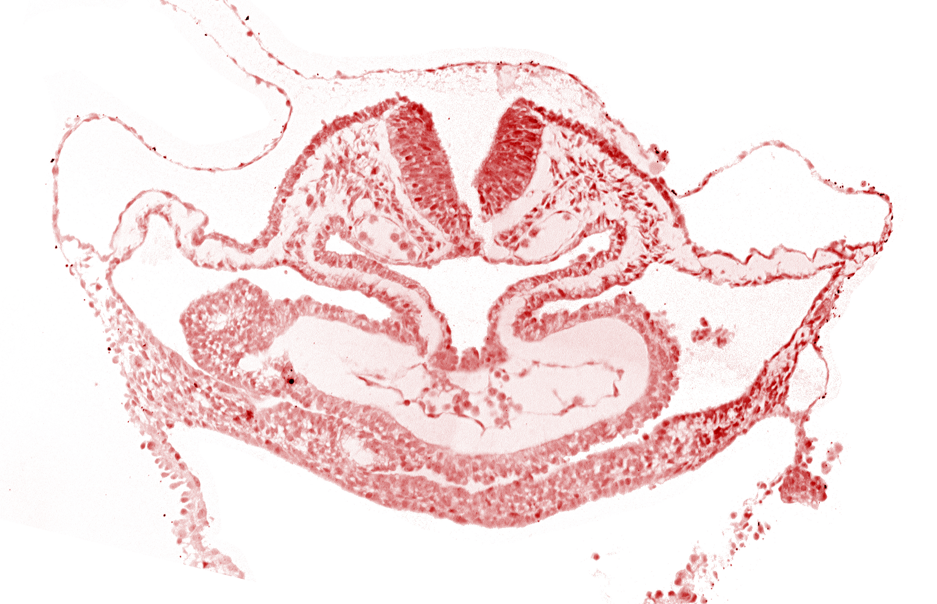 atrial canal, caudal edge of otic placode, dorsal aorta, edge of presumptive left atrium, hepatic plate, neural fold [rhombencephalon (Rh. C)], presumptive left atrium, presumptive right atrium