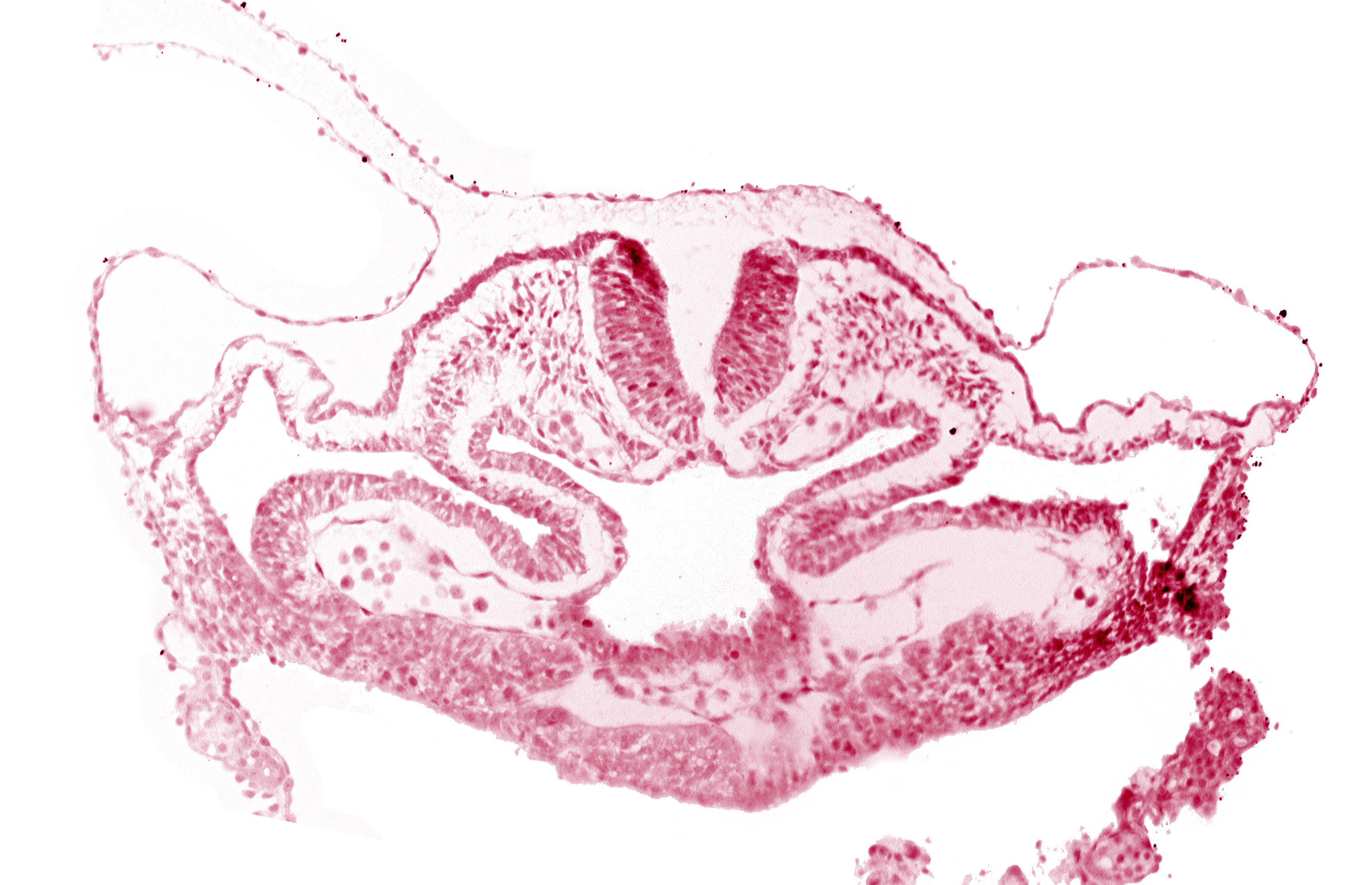 atrial canal, cephalic neuropore, foregut, hepatic plate, neural fold [rhombencephalon (Rh. C)], presumptive left atrium, presumptive right atrium, primordial pericardioperitoneal canal (pleural cavity), septum transversum, surface ectoderm