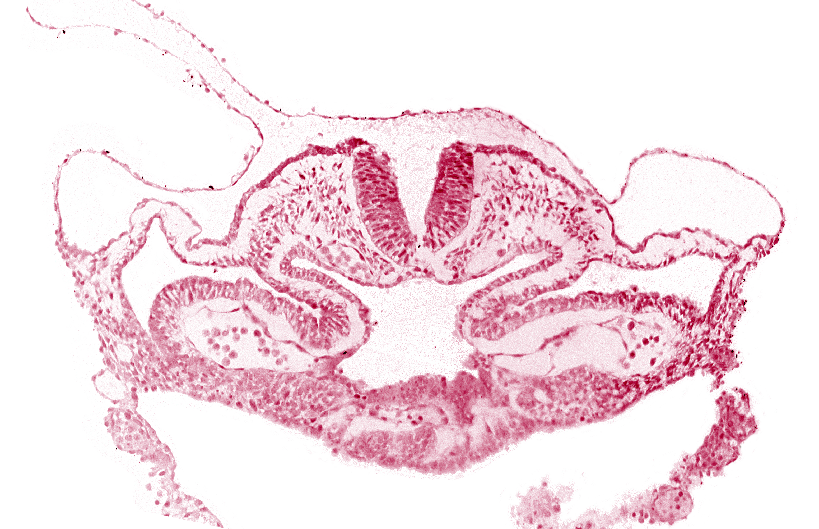 alar plate(s), basal plate, cephalic intestinal portal, dorsal aorta, head mesenchyme, hepatic plate / septum transversum region, neural fold [rhombencephalon (Rh. C)], notochordal plate, presumptive left atrium, presumptive right atrium, primordial pericardioperitoneal canal (pleural cavity), sulcus limitans