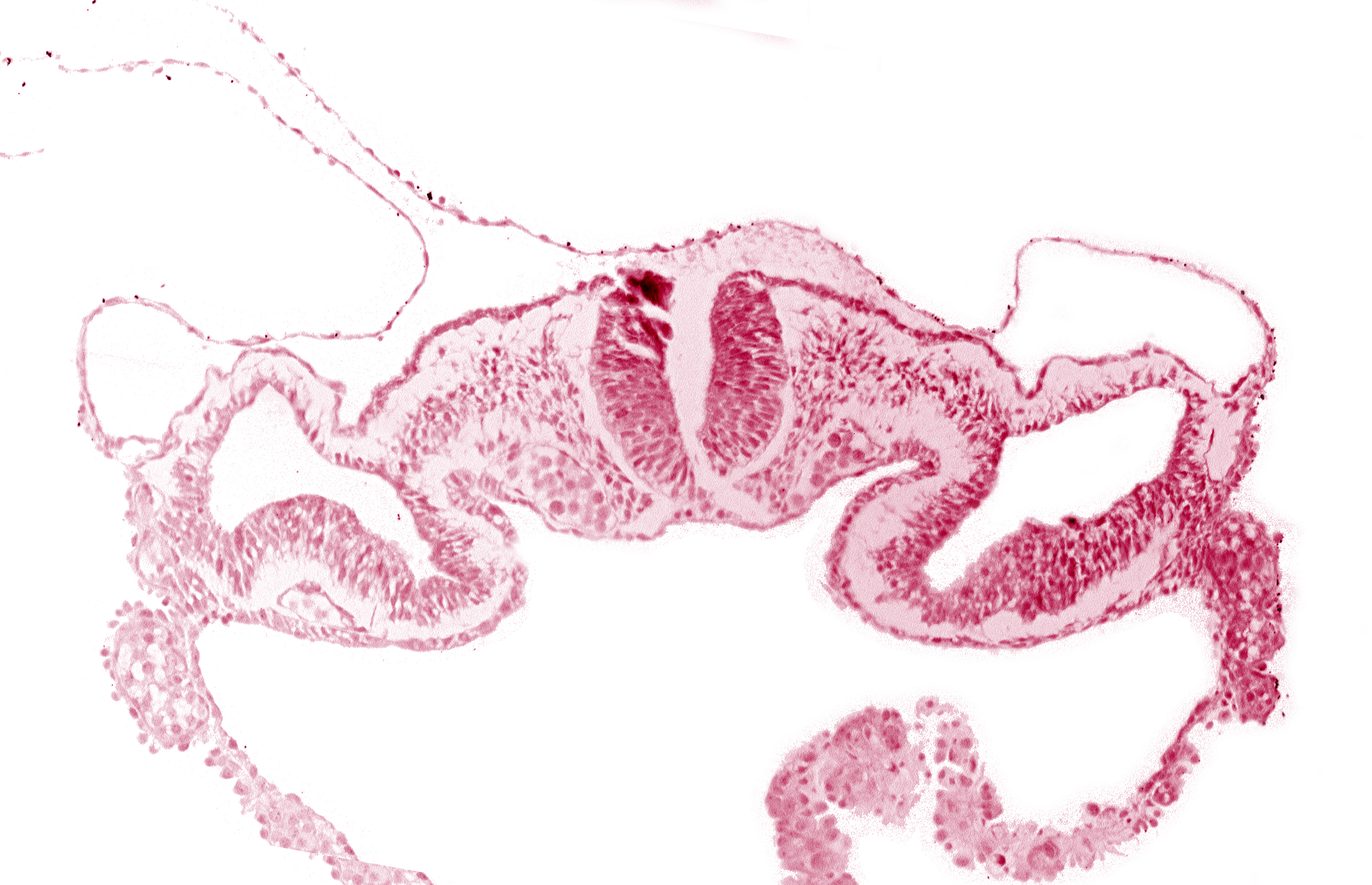 midgut, presumptive right atrium, primordial peritoneal cavity, surface ectoderm, umbilical vesicle cavity