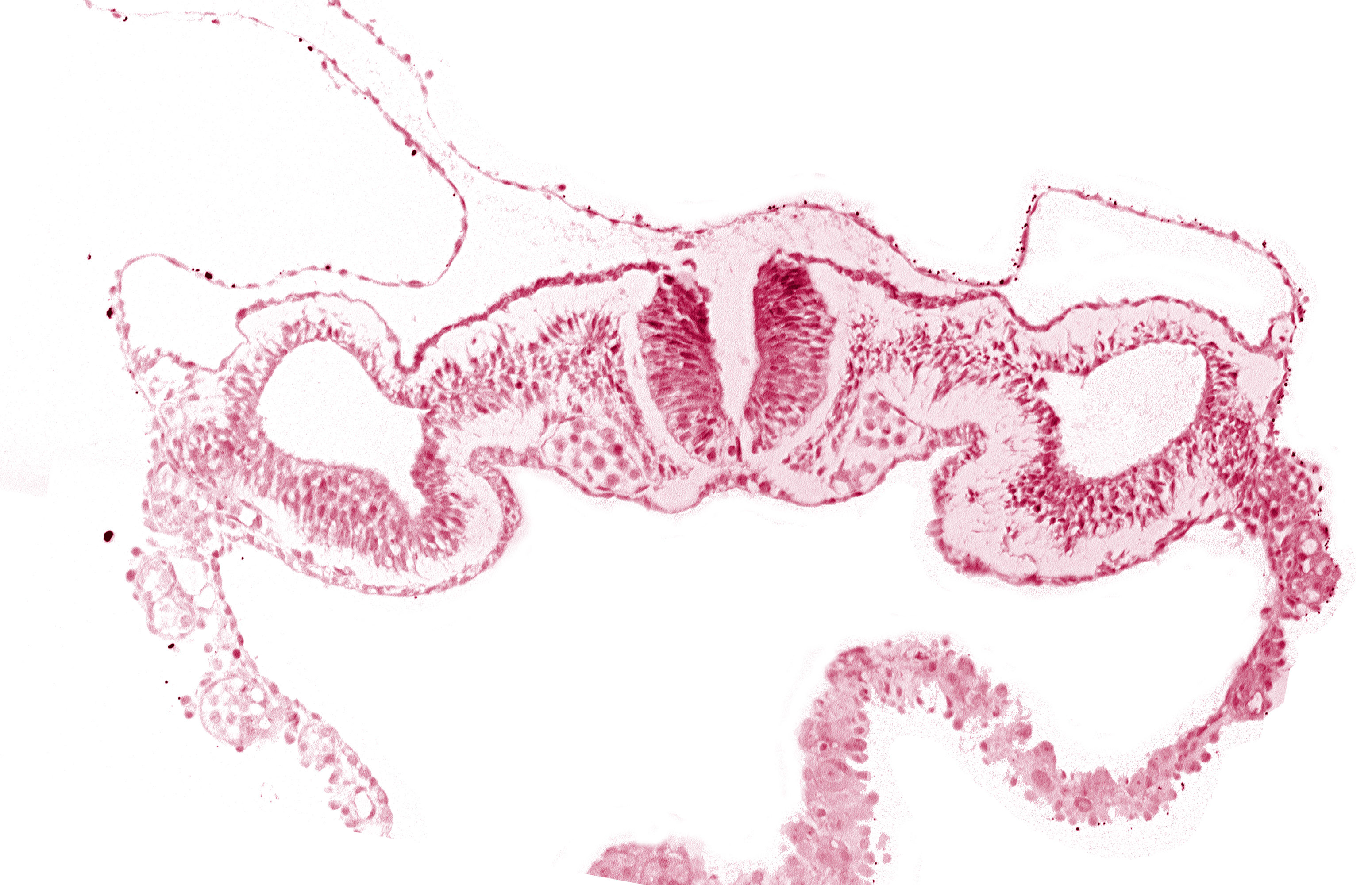 alar plate(s), basal plate, dorsal aorta, dorsal intersegmental artery, midgut, primordial peritoneal cavity, sulcus limitans, umbilical vesicle wall