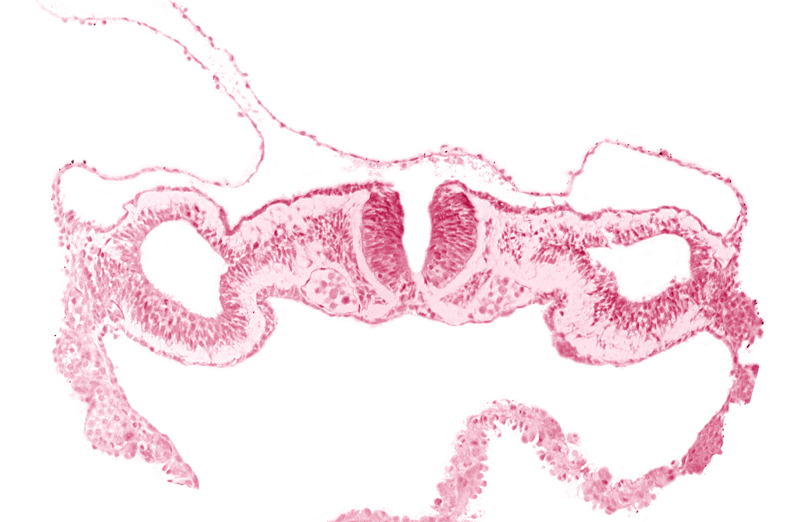 amnion attachment, artifact separation(s), cephalic edge of somite 1 (O-1), dorsal aorta, junction of neural ectoderm and surface ectoderm, junction of neural fold and surface ectoderm, midgut, neural fold [rhombencephalon (Rh. D)], primordial peritoneal cavity, umbilical vesicle wall