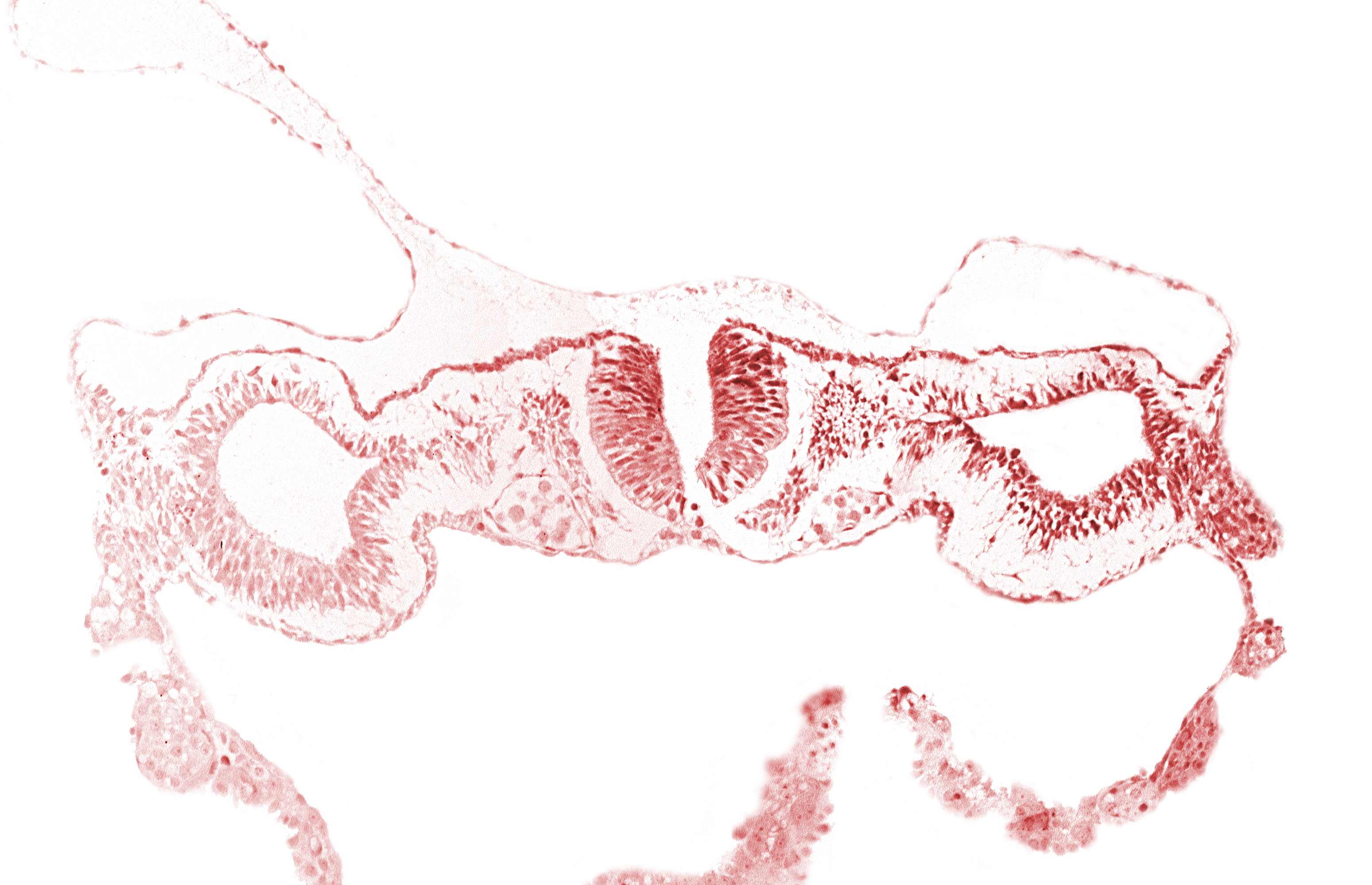 dorsal aorta, junction of neural ectoderm and surface ectoderm, junction of neural fold and surface ectoderm, midgut, neural fold [rhombencephalon (Rh. D)], notochordal plate, primordial peritoneal cavity, somite 1 (O-1)