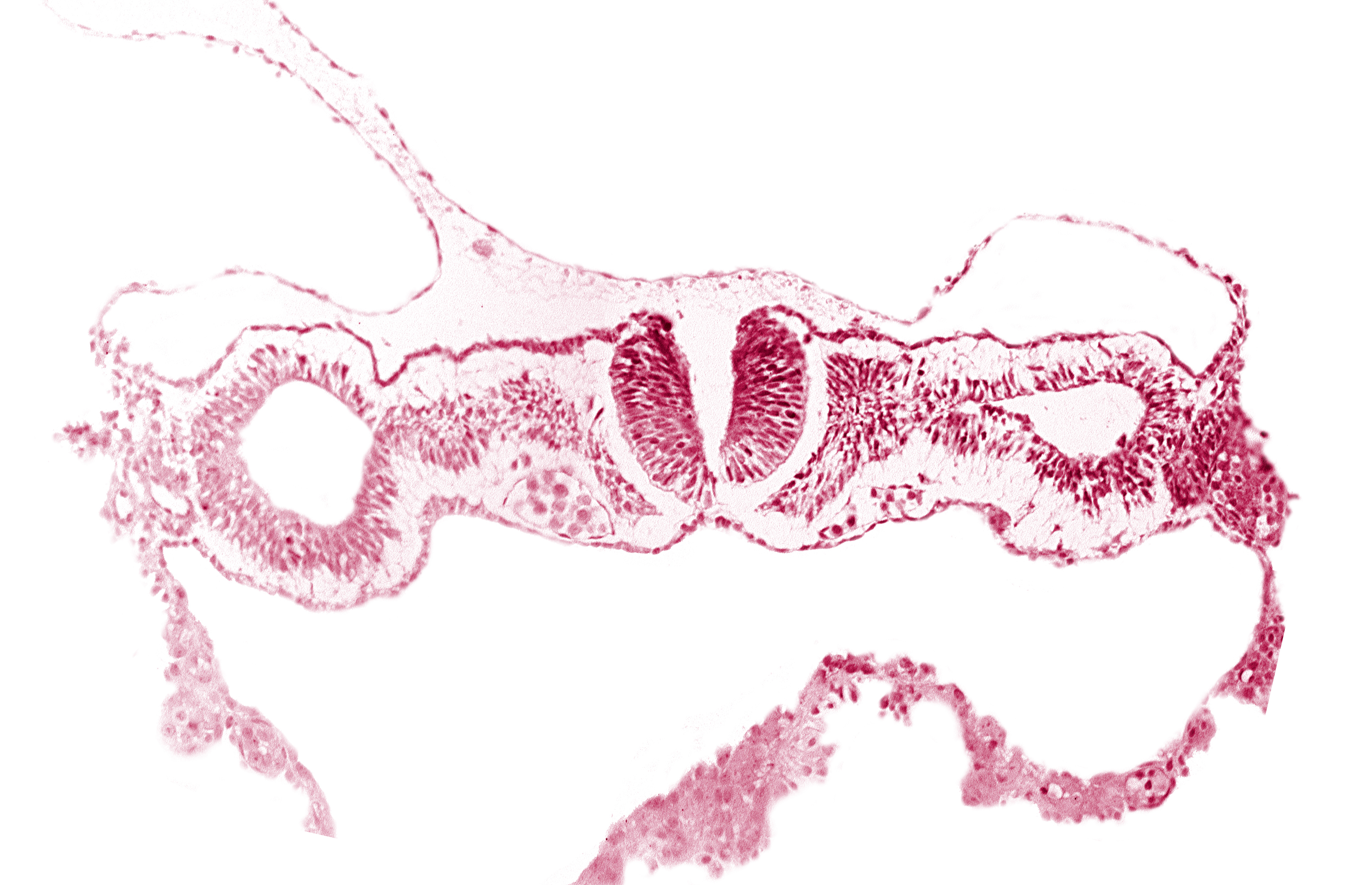 cephalic neuropore, dorsal aorta, intermediate mesenchyme, notochordal plate, primordial peritoneal cavity, sclerotomal cells, somatopleuric mesoderm, somite 1 (O-1), splanchnopleuric mesoderm
