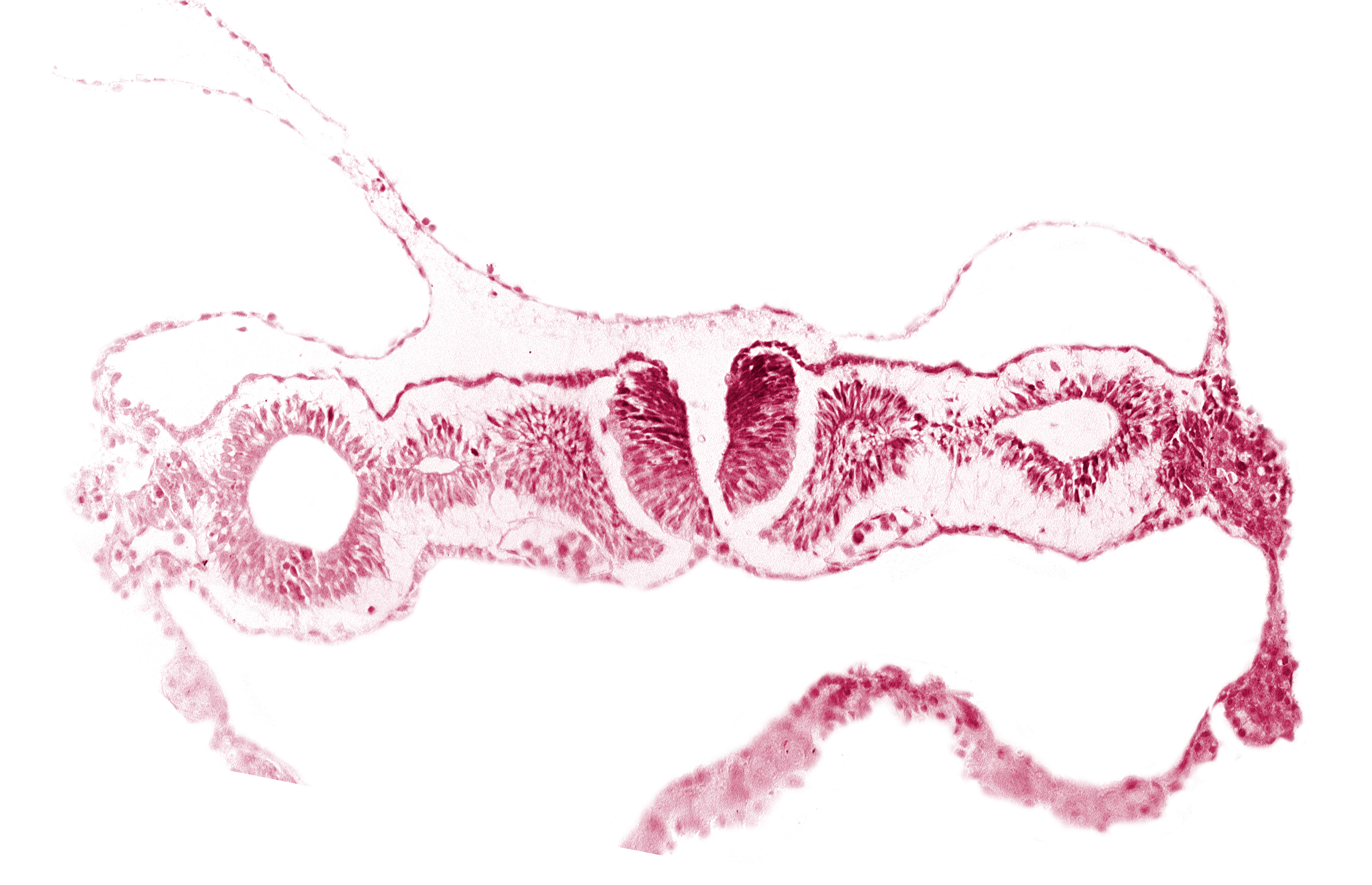 alar plate(s), basal plate, dorsal aorta, notochordal plate, primordial peritoneal cavity, somitocoel 1, sulcus limitans