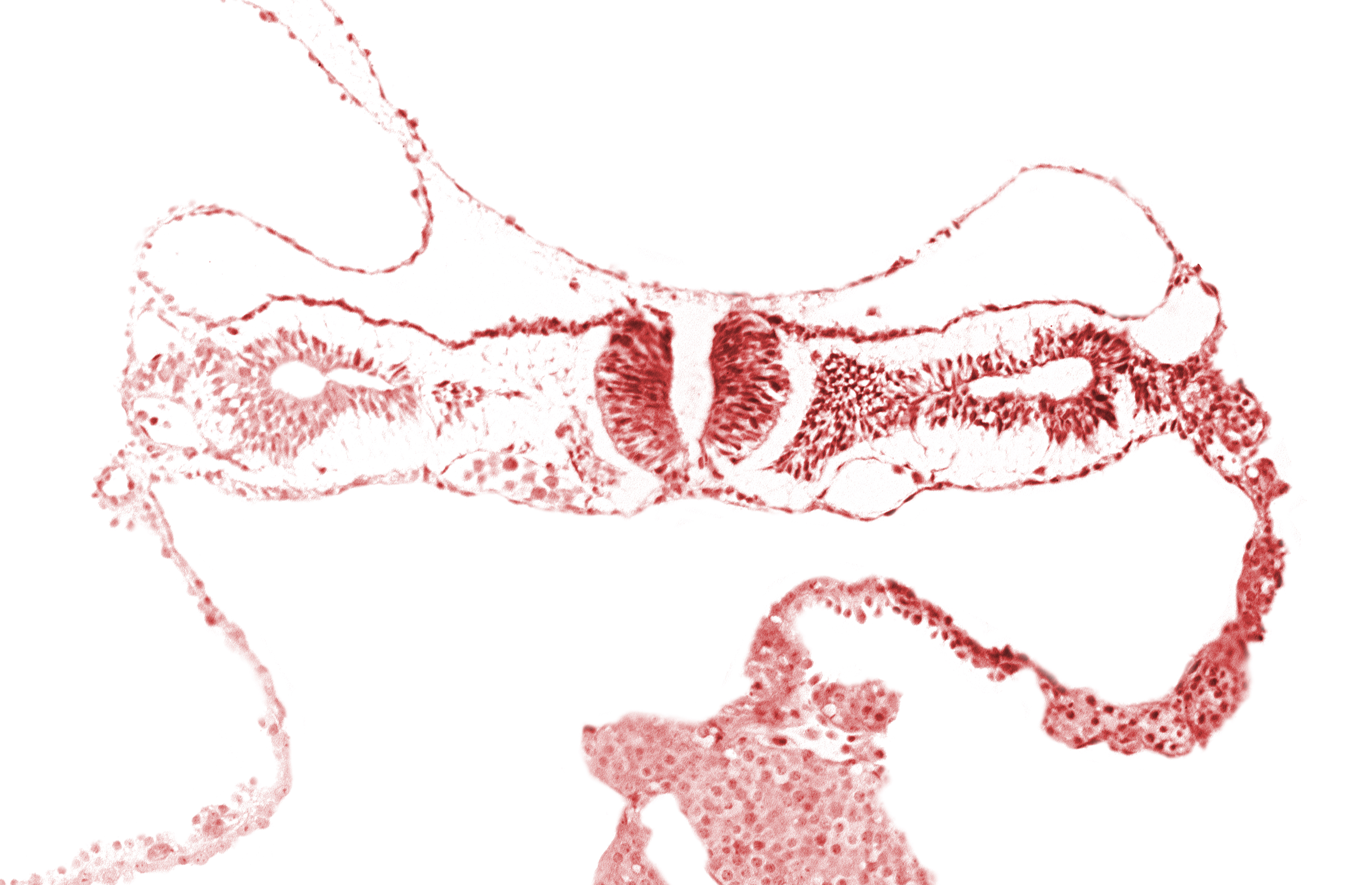amnion, cephalic edge of somite 2 (O-2), dorsal aorta, midgut, neural fold [rhombencephalon (Rh. D)], primordial peritoneal cavity, right umbilical vein, umbilical vesicle wall