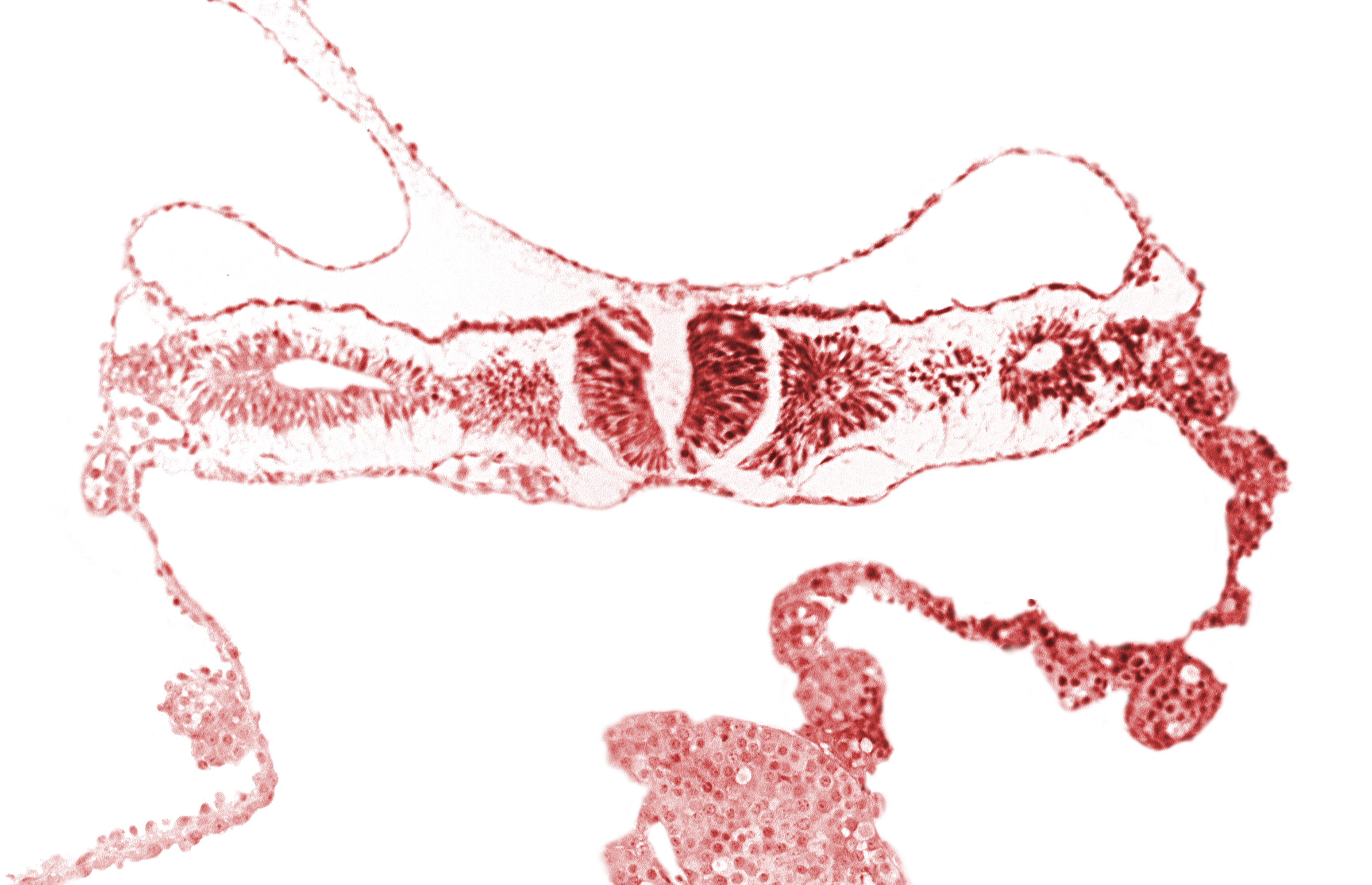 dorsal aorta, midgut, nephrogenic cord, neural fold [rhombencephalon (Rh. D)], primordial peritoneal cavity, right umbilical vein, somitocoel 2