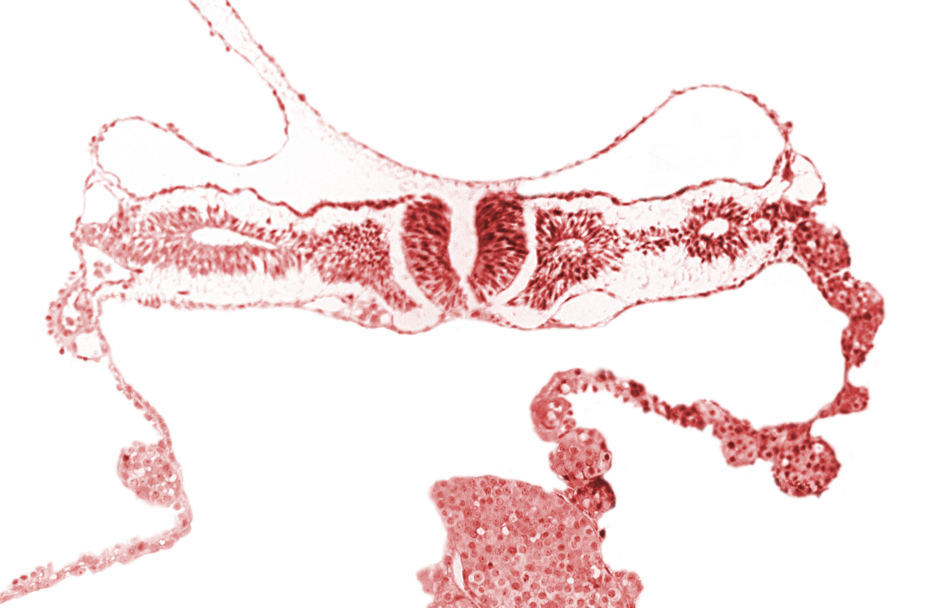 dorsal aorta, midgut, nephrogenic cord, neural fold [rhombencephalon (Rh. D)], primordial peritoneal cavity, right umbilical vein, somitocoel 2