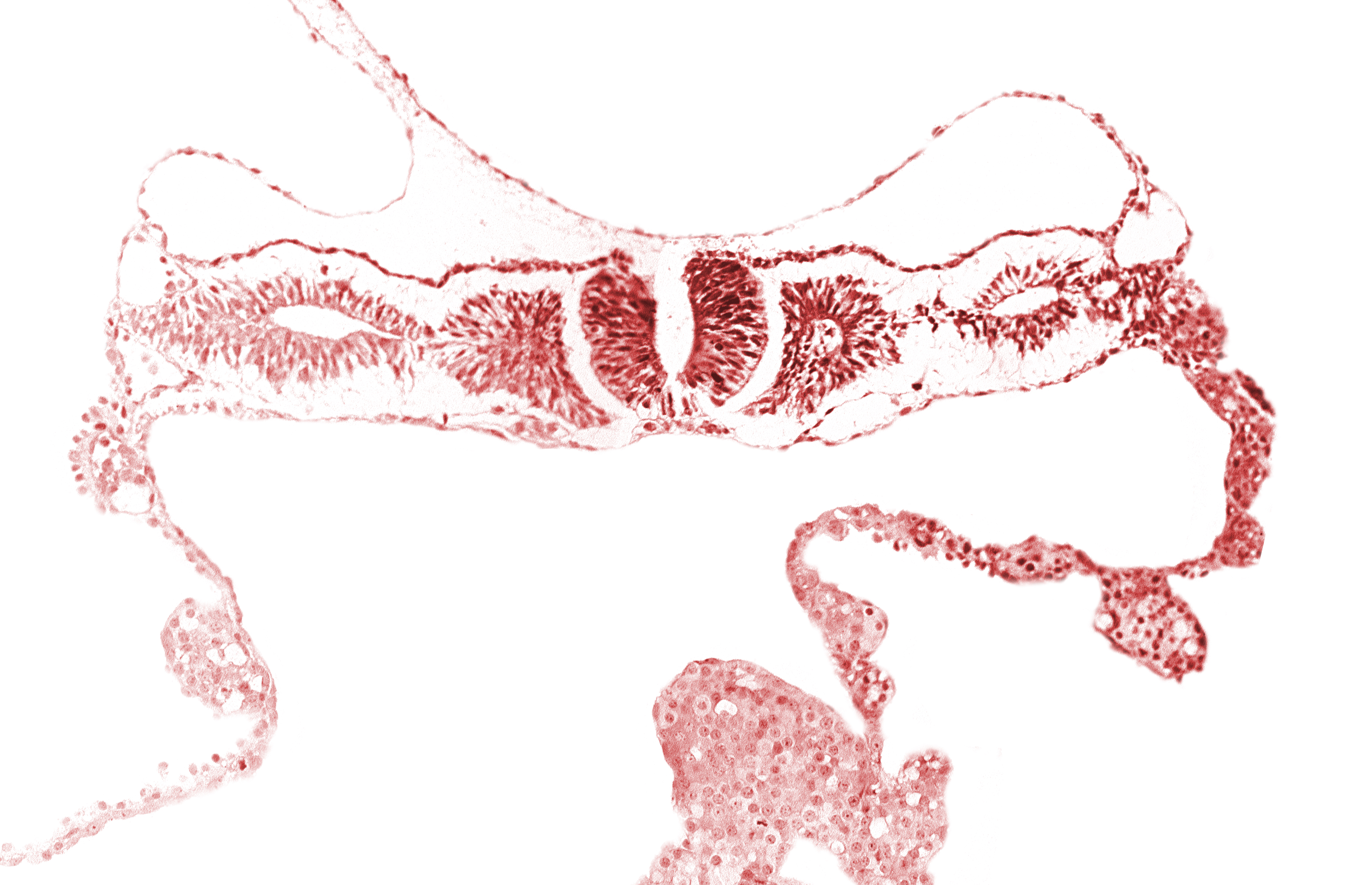 cephalic neuropore, dorsal aorta, nephrogenic cord, neural fold [rhombencephalon (Rh. D)], primordial peritoneal cavity, right umbilical vein, somite 2 (O-2), somitocoel 2