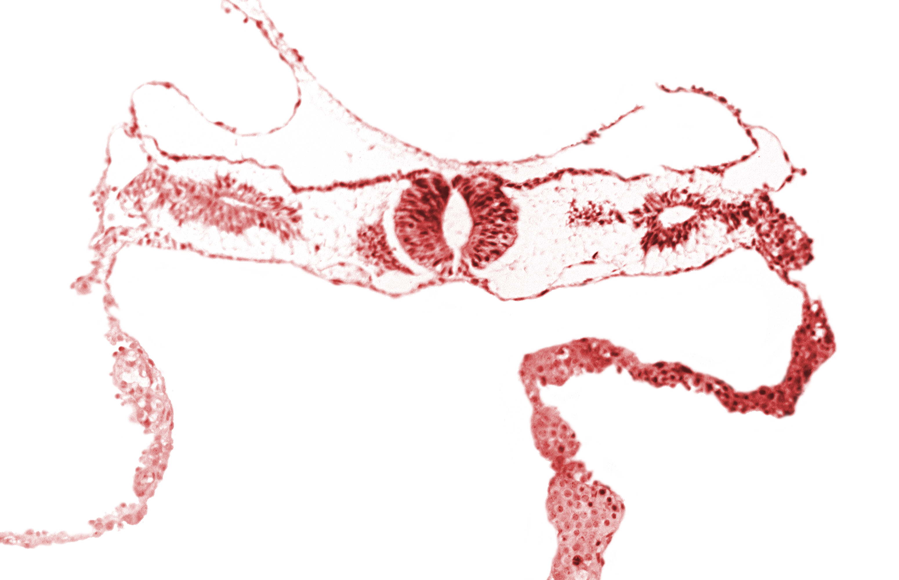 cephalic edge of neural tube, cephalic edge of somite 3 (O-3), fusing neural folds [rhombencephalon (Rh. D)], midgut, primordial peritoneal cavity, surface ectoderm