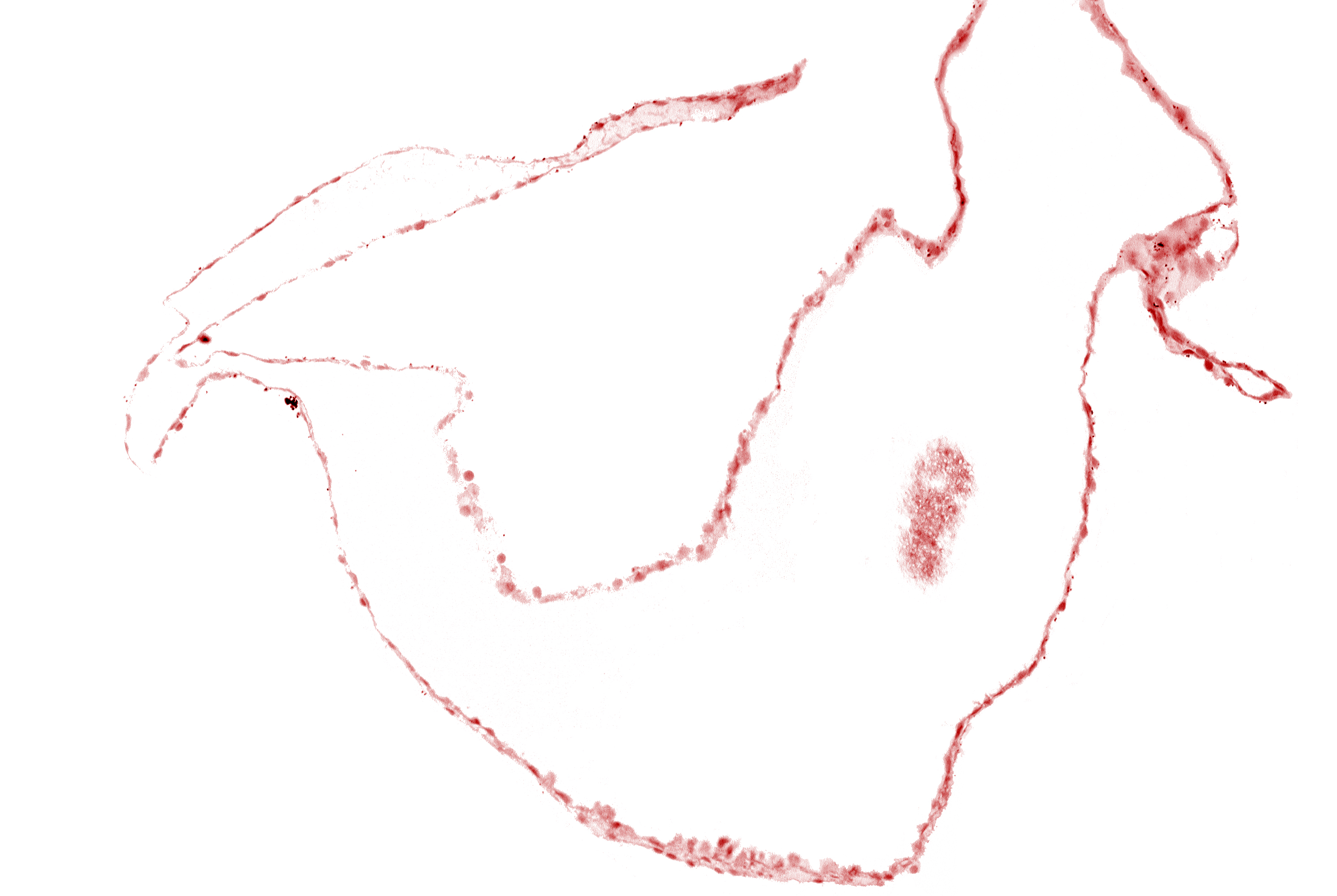 cephalic edge of left neural fold (primordial diencephalon)