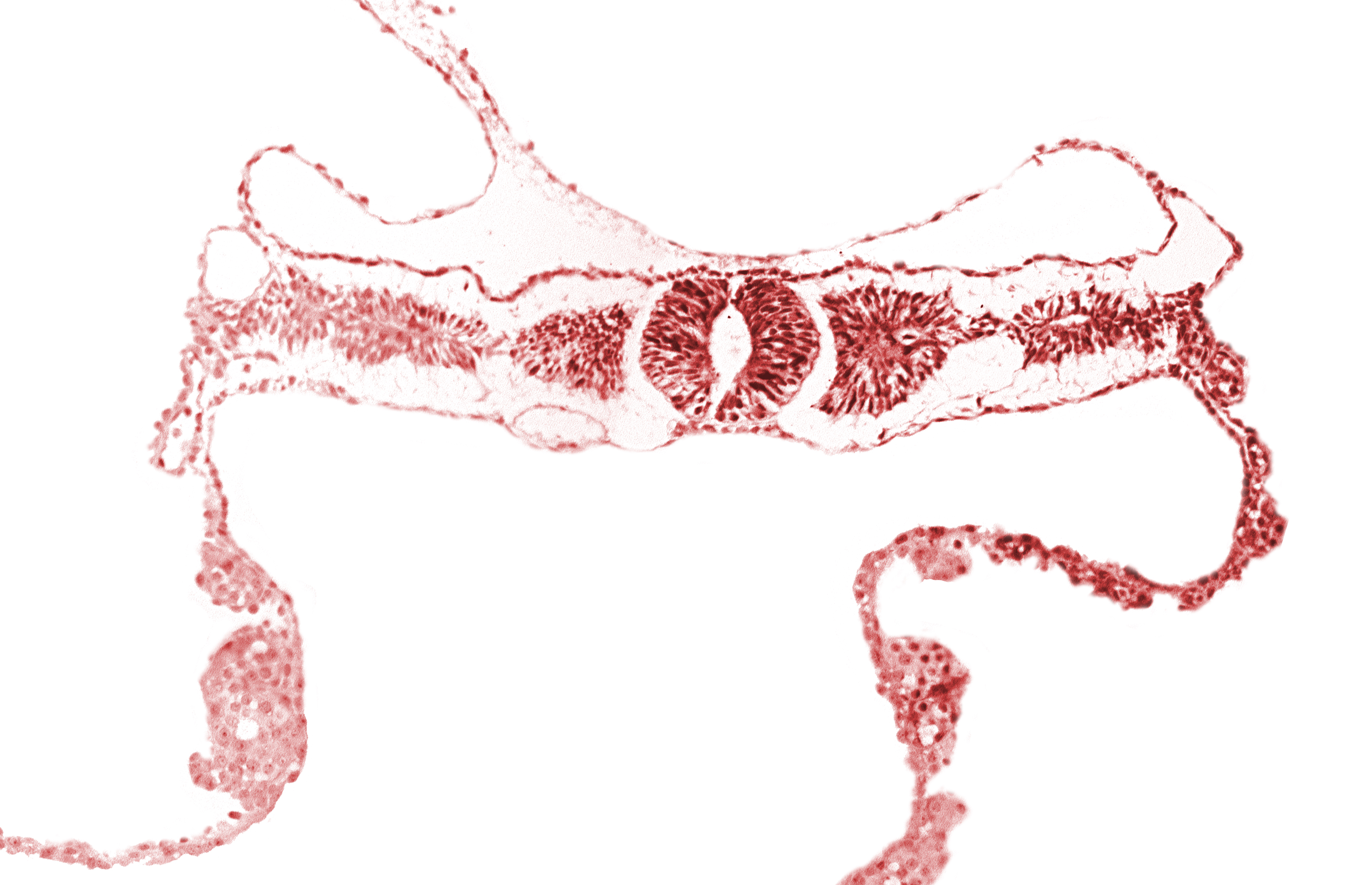 amnion attachment, dorsal aorta, midgut, somite 3 (O-3), umbilical vesicle wall