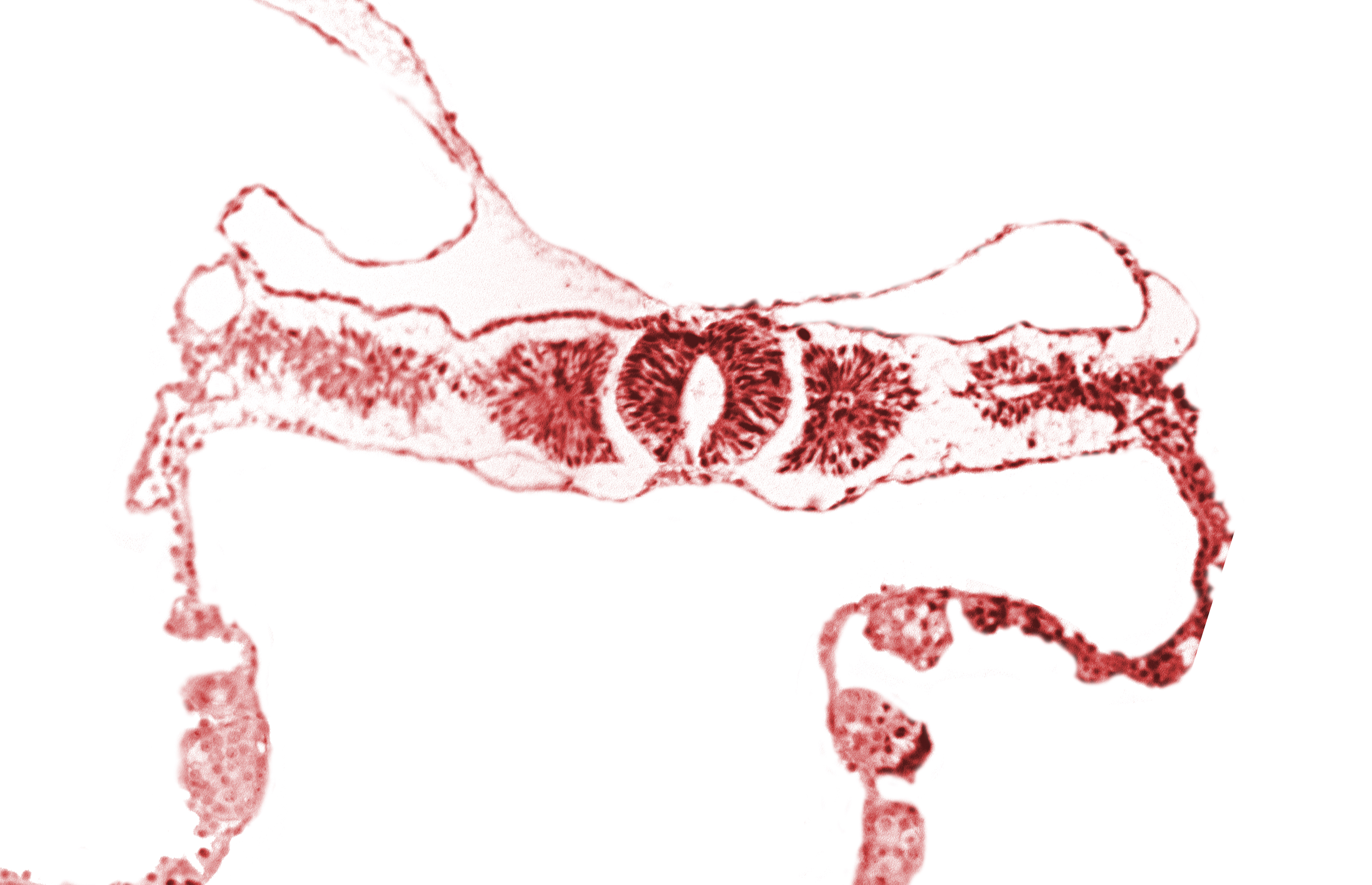 amnion attachment, dorsal aorta, endoderm, midgut, somite 3 (O-3), somitocoel 3, sulcus limitans, surface ectoderm, umbilical vesicle wall