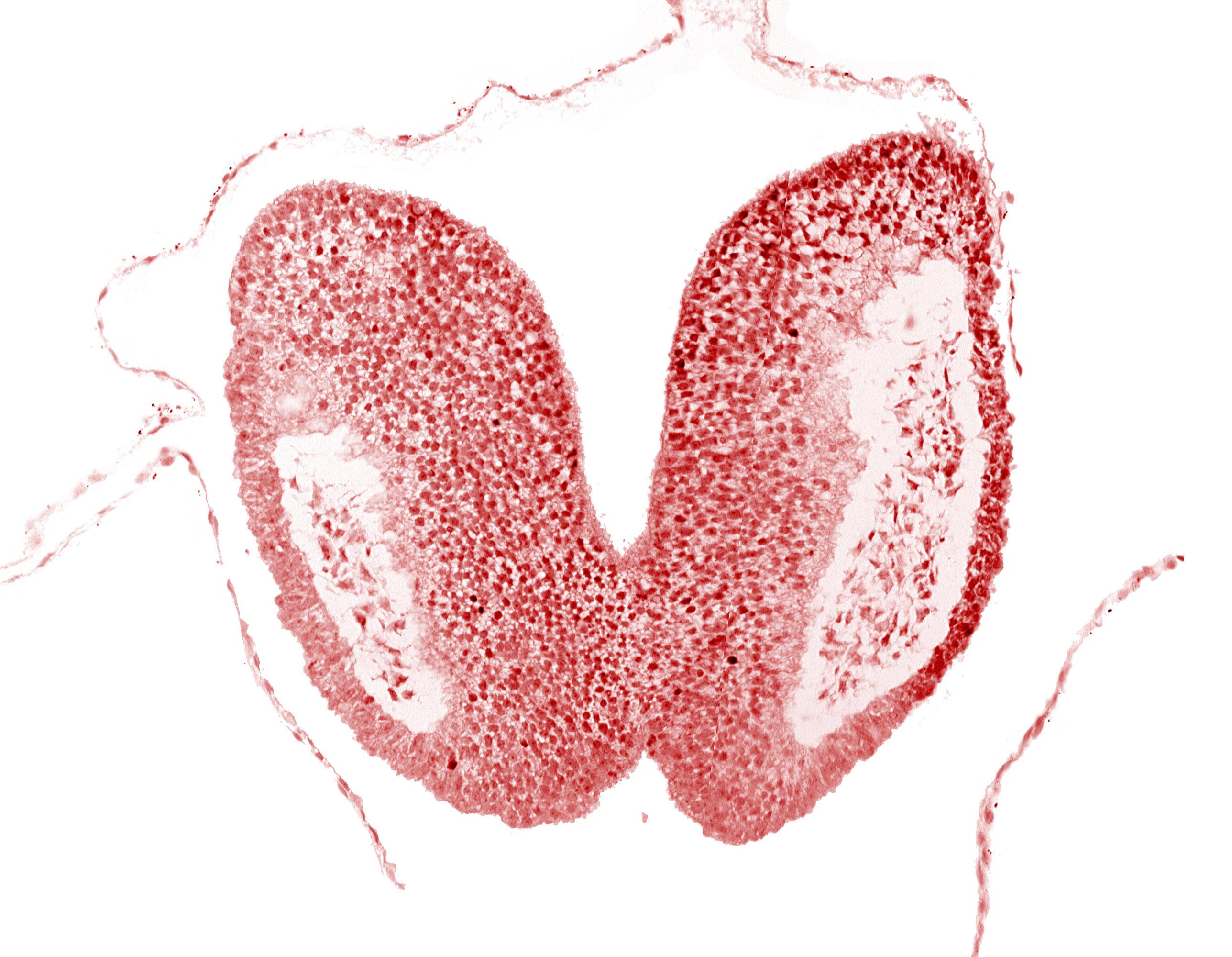 artifact space(s), chiasmatic plate (D1), head mesenchyme, junction of neural fold and surface ectoderm, neural fold [primordial diencephalon (D2)], neural fold [primordial telencephalon medium (T)], neural groove, optic nerve primordium (CN II) [primordial diencephalon (D1)], optic sulcus [primordial diencephalon (D1)], surface ectoderm of head, terminal notch