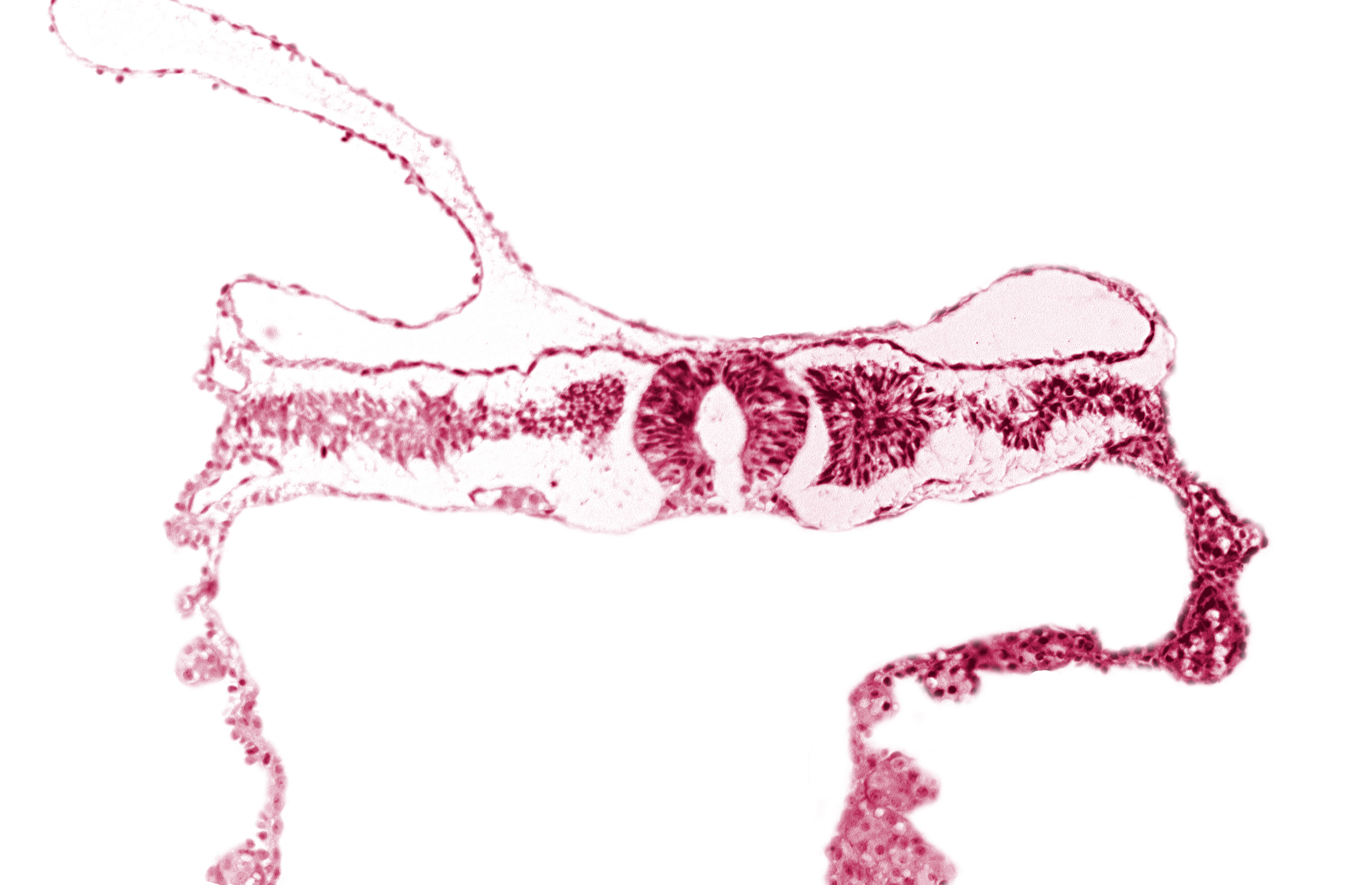 cephalic part of somite 4 (O-4), midgut, neural fold [rhombencephalon (Rh. D)], right umbilical vein