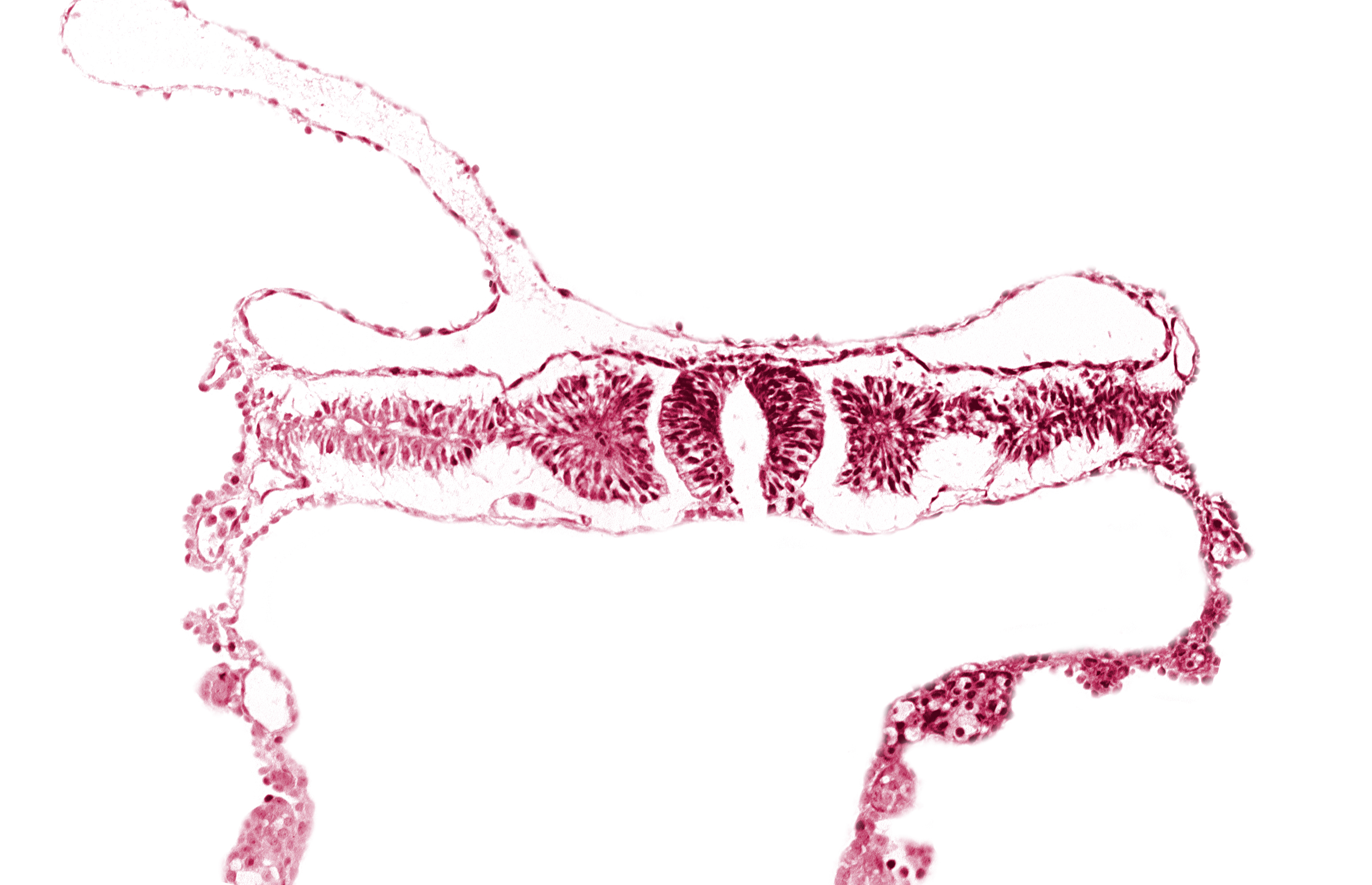 artifact separation(s), dorsal aorta, intermediate mesenchyme, midgut, neural fold [rhombencephalon (Rh. D)], somite 4 (O-4)