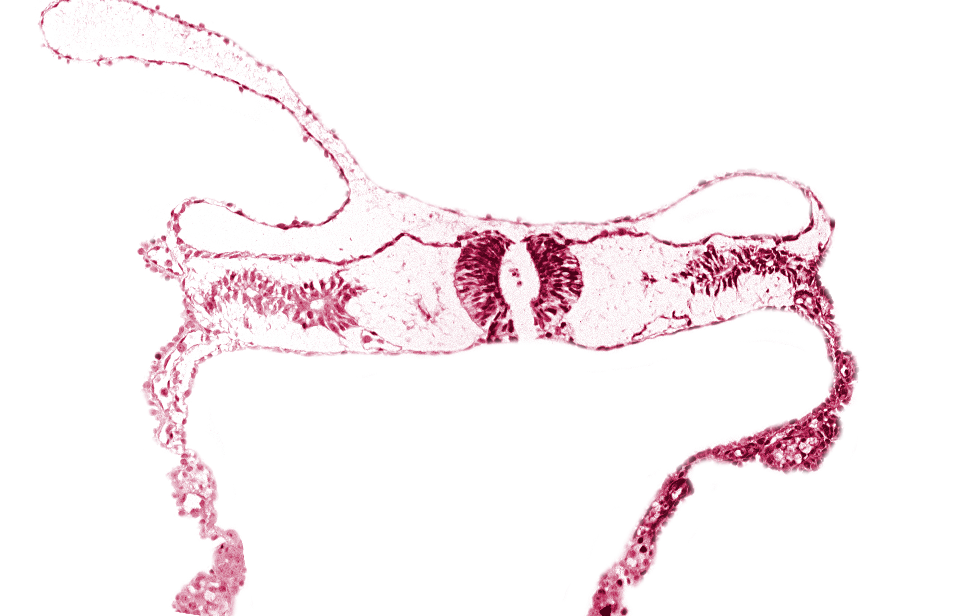 amnion attachment, dorsal aorta, midgut, neural fold (spinal cord), somite 4-5 intersegmental region, umbilical vesicle wall
