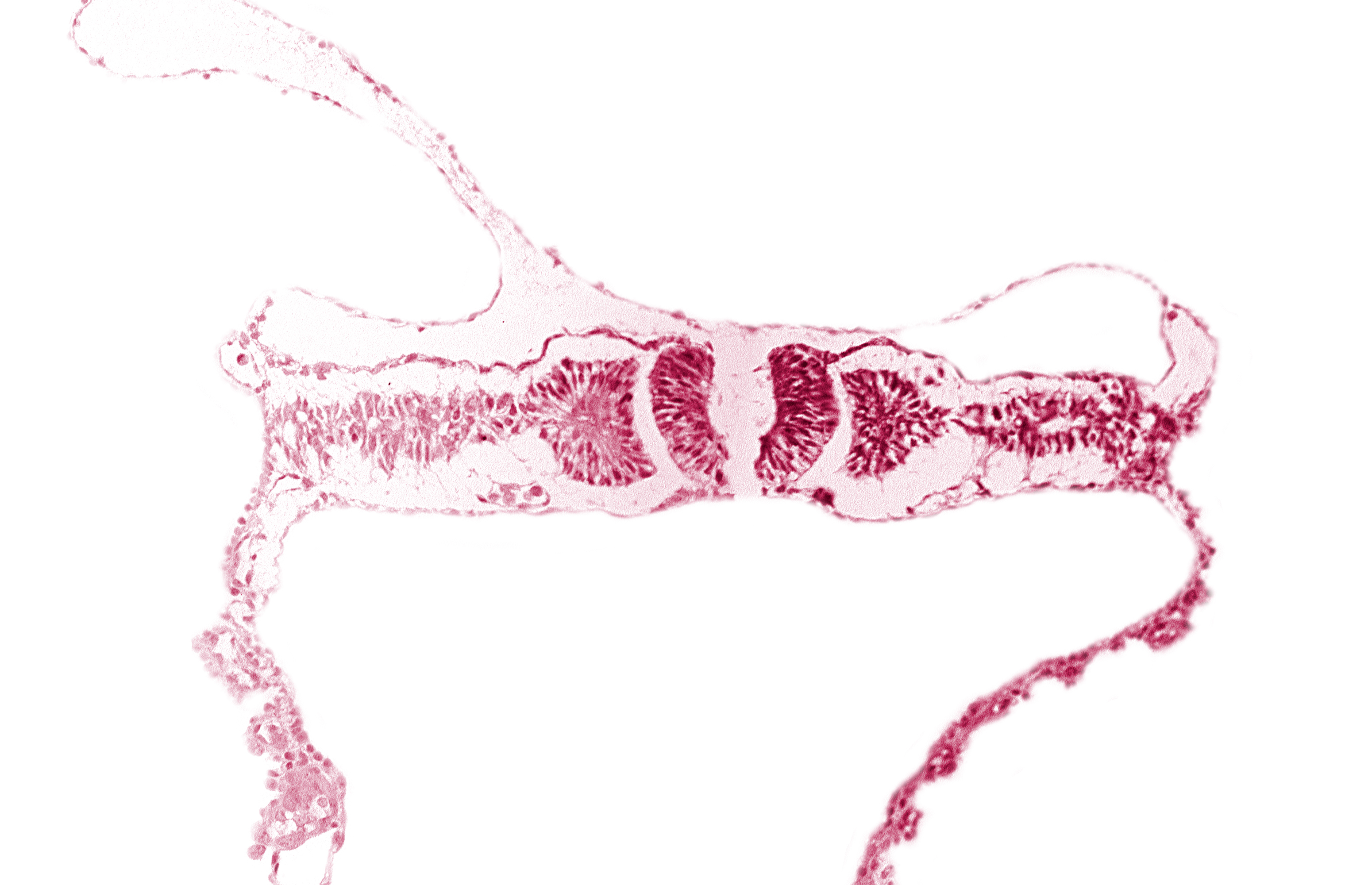 dorsal aorta, somite 5 (C-1)