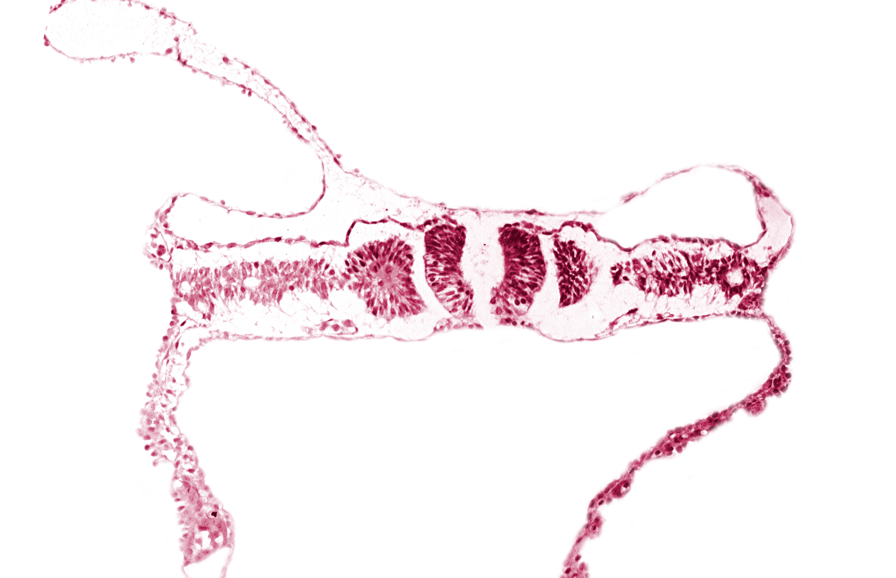 caudal edge of somite 5 (C-1), caudal neuropore, nephrogenic cord