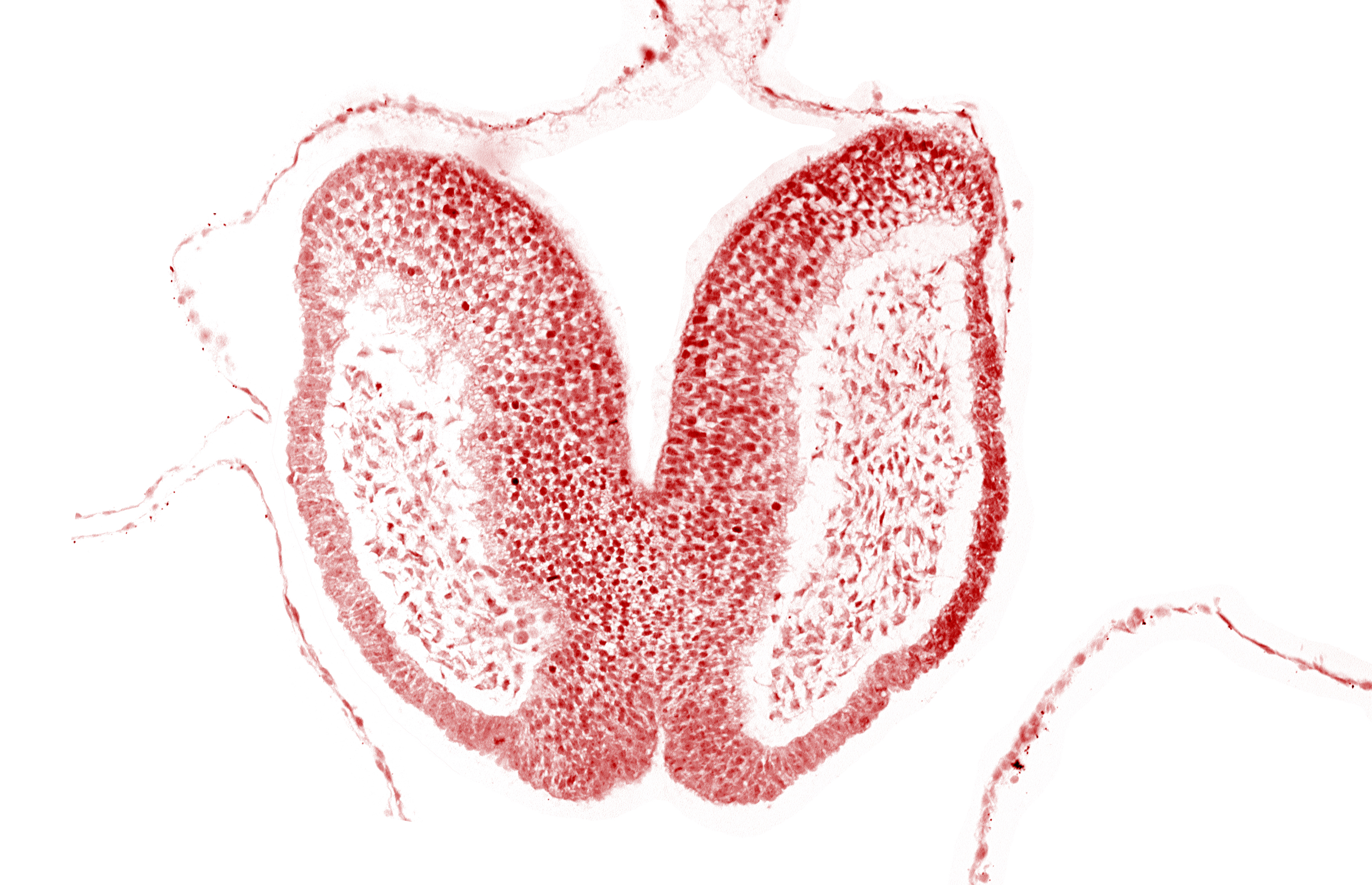 amniotic cavity, artifact space(s), cephalic neuropore, chiasmatic plate (D1), head mesenchyme, junction of neural fold and surface ectoderm, maxillary prominence of pharyngeal arch 1, neural fold [primordial diencephalon (D2)], neural fold [primordial telencephalon medium (T)], neural groove, surface ectoderm of head, terminal notch