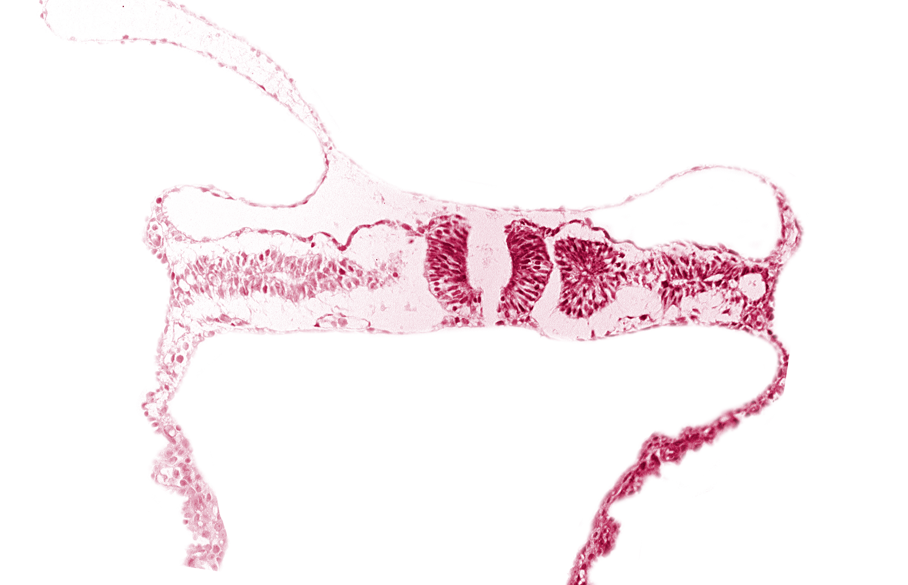 amnion attachment, amniotic cavity, caudal neuropore, dorsal aorta, extra-embryonic coelom, midgut, nephrogenic cord, right umbilical vein, somite 6 (C-2), somitocoel 6, umbilical vesicle cavity, umbilical vesicle wall