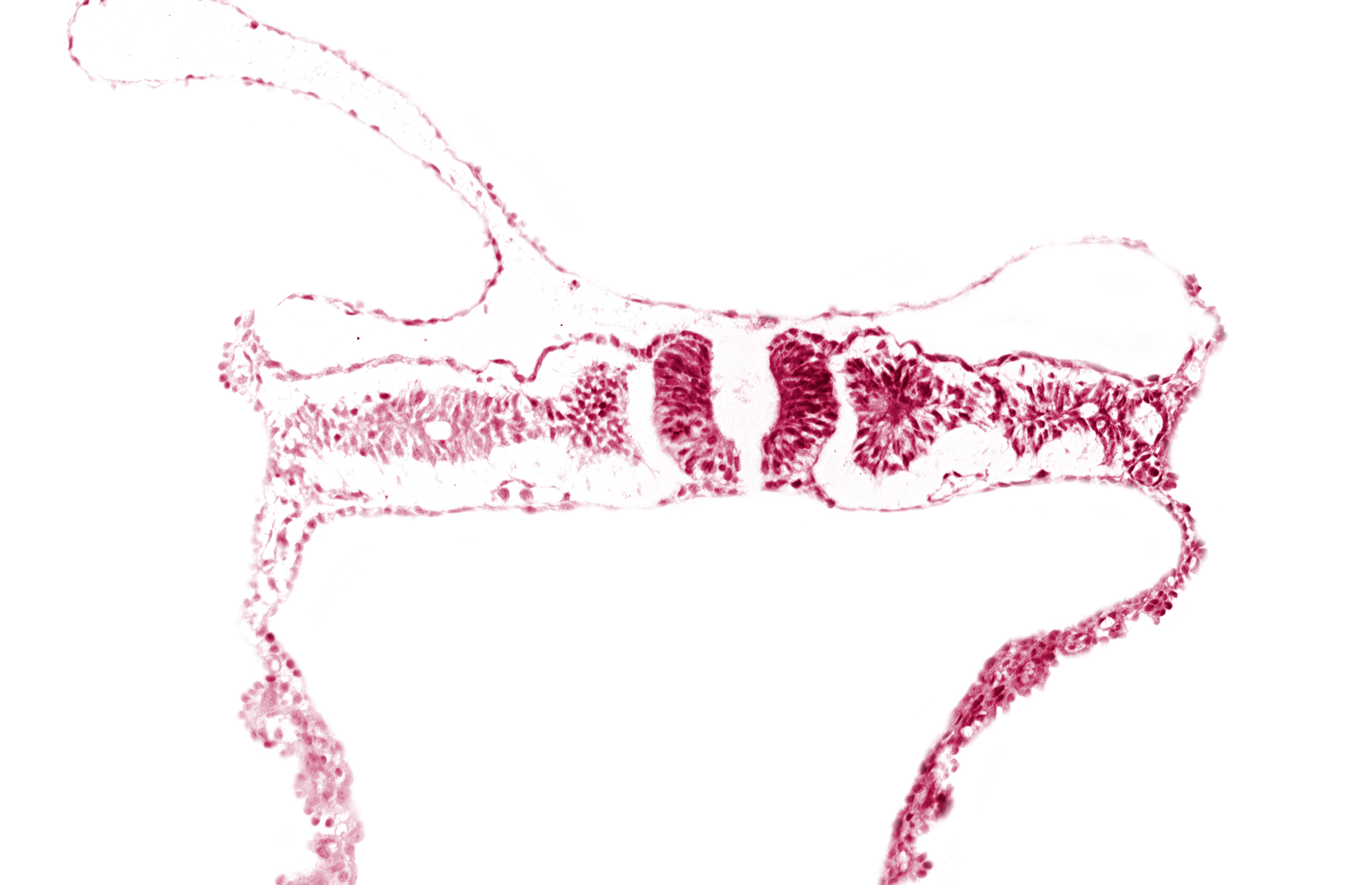 amnion attachment, amniotic cavity, caudal neuropore, dorsal aorta, extra-embryonic coelom, midgut, nephrogenic cord, right umbilical vein, somite 6 (C-2), somitocoel 6, umbilical vesicle cavity, umbilical vesicle wall