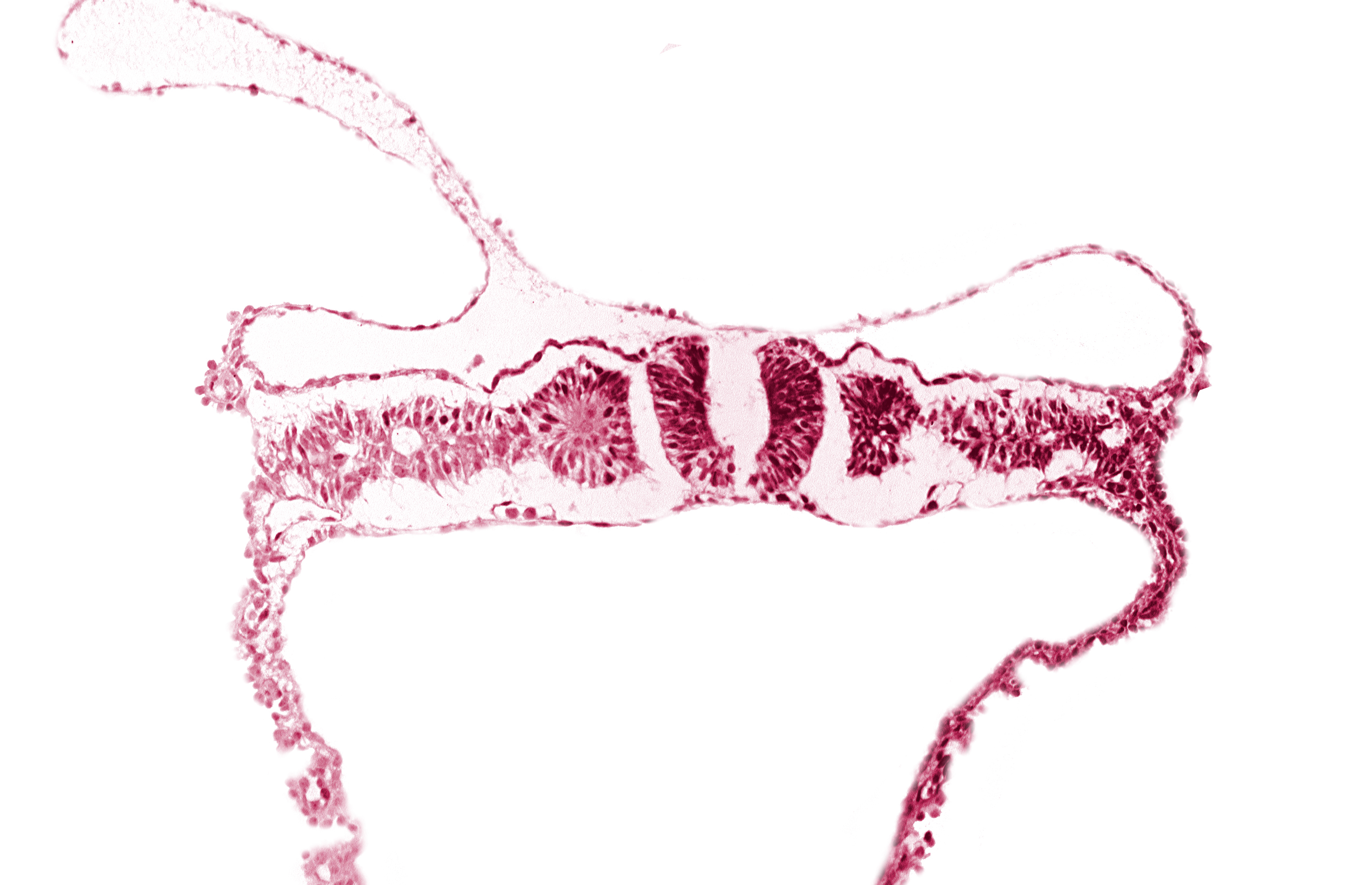 amnion, nephrogenic cord, notochordal plate, primordial peritoneal cavity, right umbilical vein, somite 6 (C-2), umbilical vesicle wall