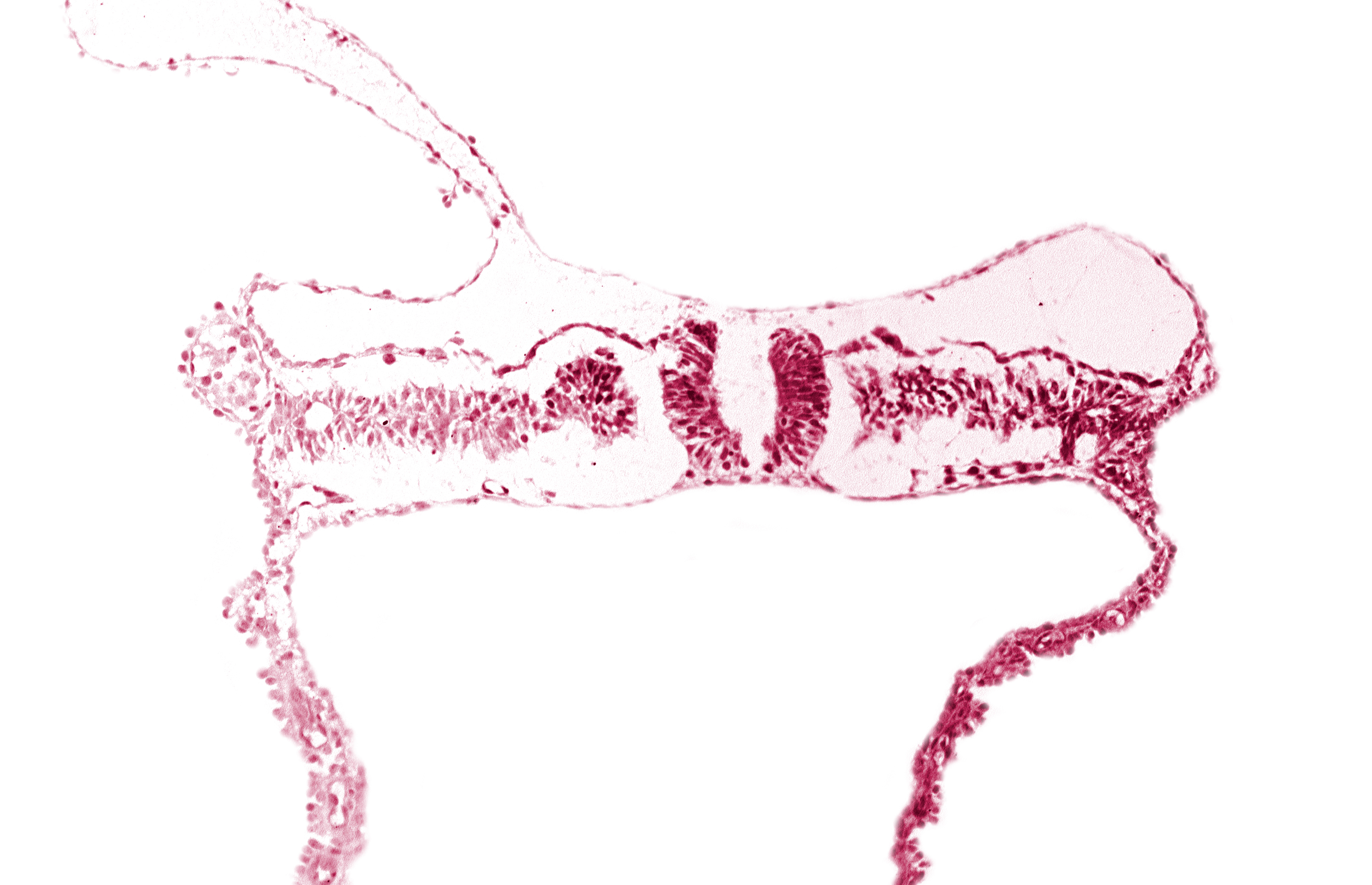 dorsal aorta, junction of neural ectoderm and surface ectoderm, lateral plate mesoderm, nephrogenic cord, neural fold, neural groove, notochordal plate, somite 7 (C-3), umbilical vesicle wall endoderm, umbilical vesicle wall mesoderm