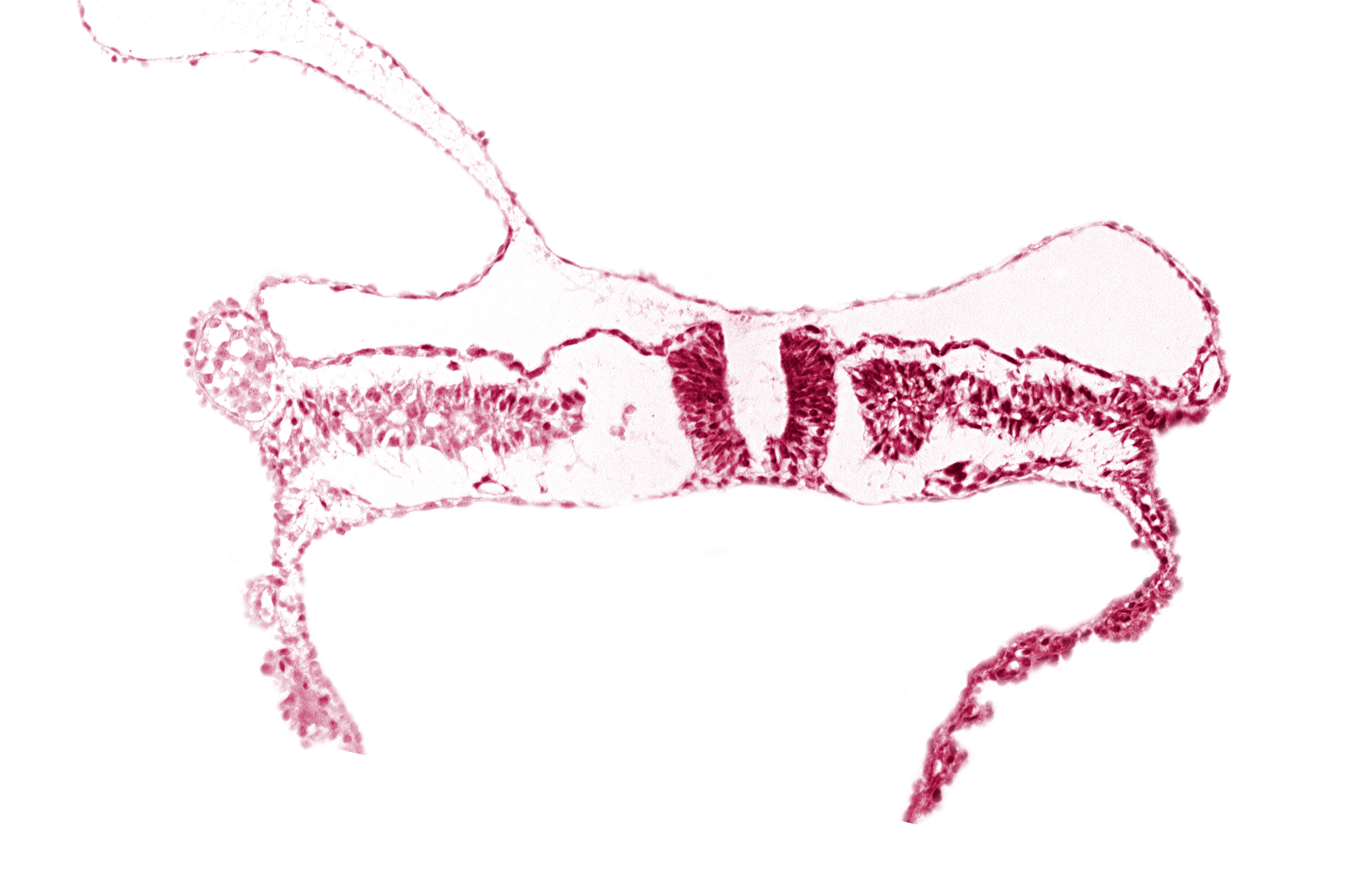 dorsal aorta, junction of neural ectoderm and surface ectoderm, lateral plate mesoderm, nephrogenic cord, neural fold, neural groove, notochordal plate, somite 7 (C-3), umbilical vesicle wall endoderm, umbilical vesicle wall mesoderm