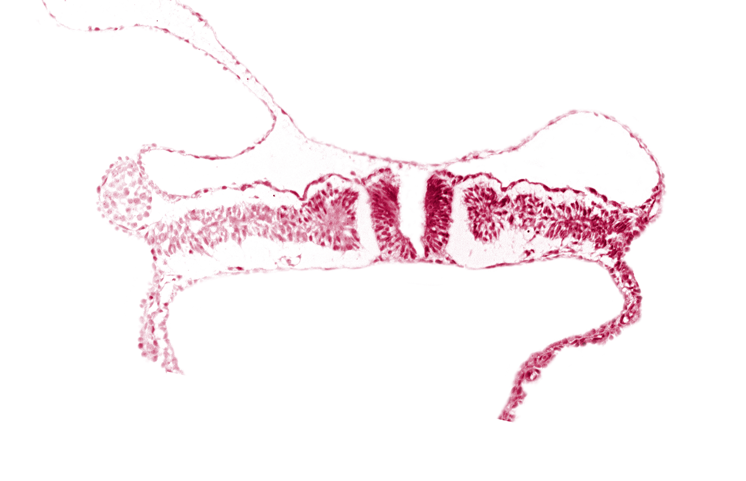 dorsal aorta, nephrogenic cord, somite 7 (C-3)