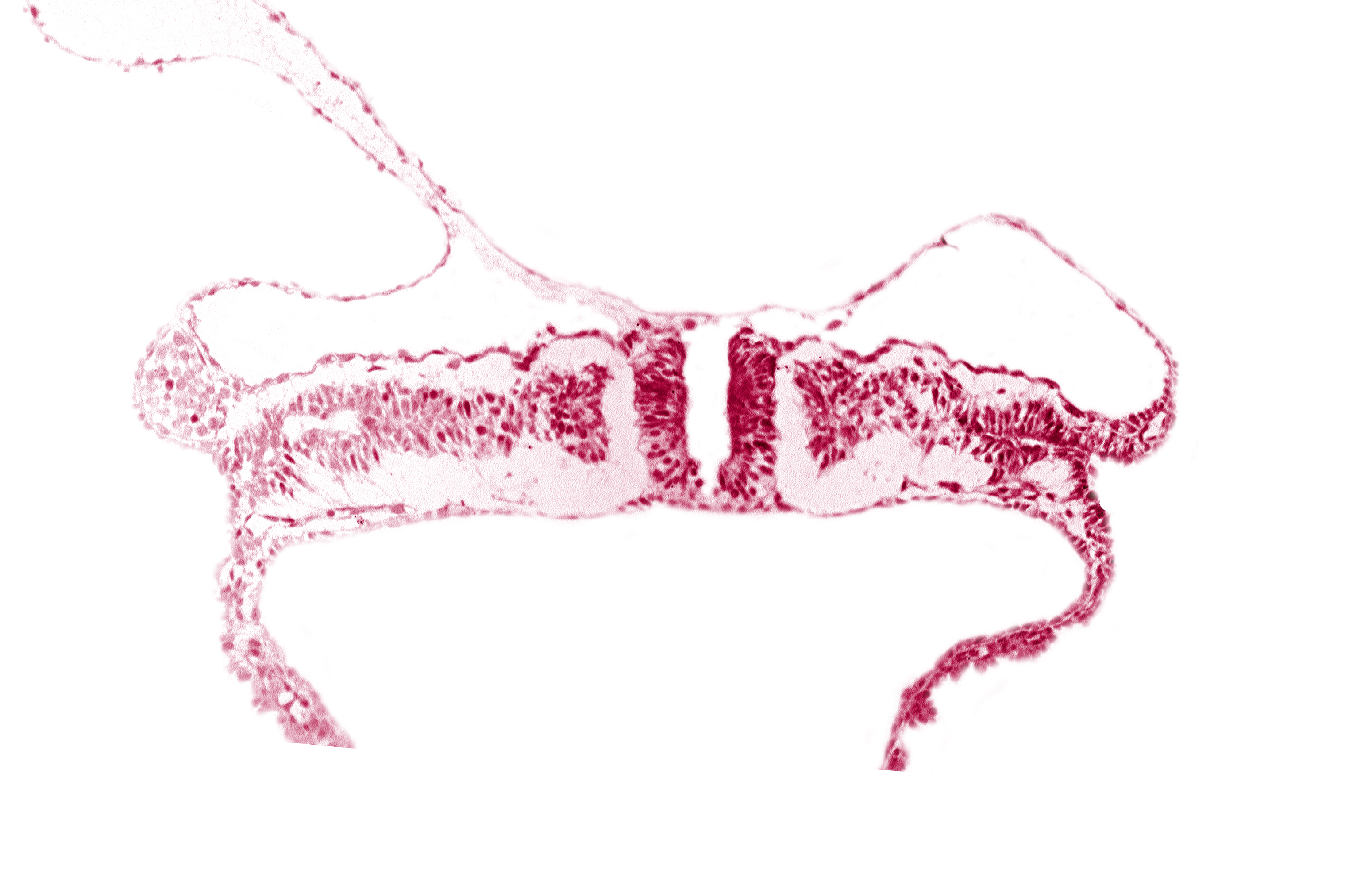 caudal neuropore, intermediate mesenchyme, lateral plate mesoderm, paraxial mesoderm, umbilical vesicle wall endoderm, umbilical vesicle wall mesoderm