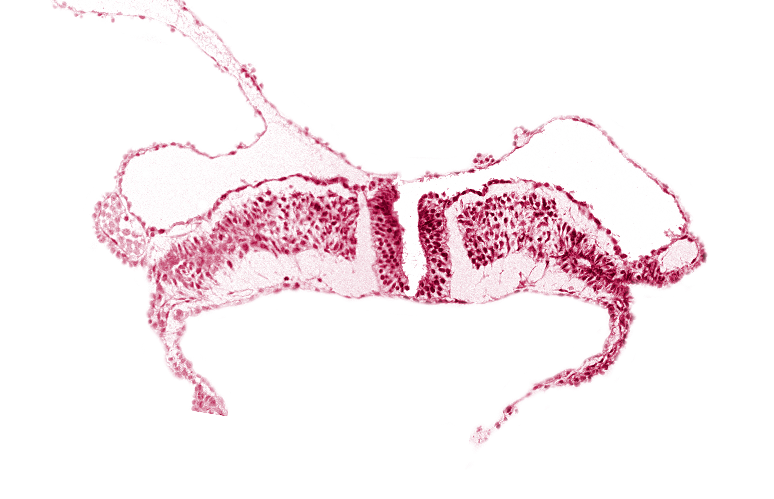 cephalic part of primordial lateral body fold, coelom, neural plate, paraxial mesoderm, splanchnopleuric mesoderm