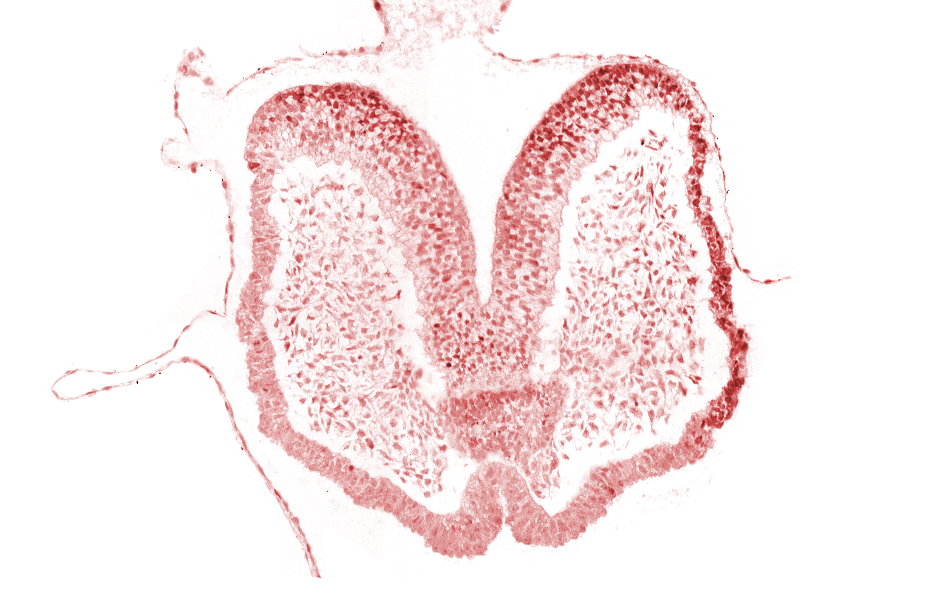 adenohypophysial primordium, artifact space(s), caudal edge of chiasmatic plate (D1), cephalic edge of aortic arch 1, head mesenchyme, neural fold [primordial diencephalon (D2)], neural groove, neurohypophysial primordium, prechordal plate (oropharyngeal membrane), stomodeum, surface ectoderm