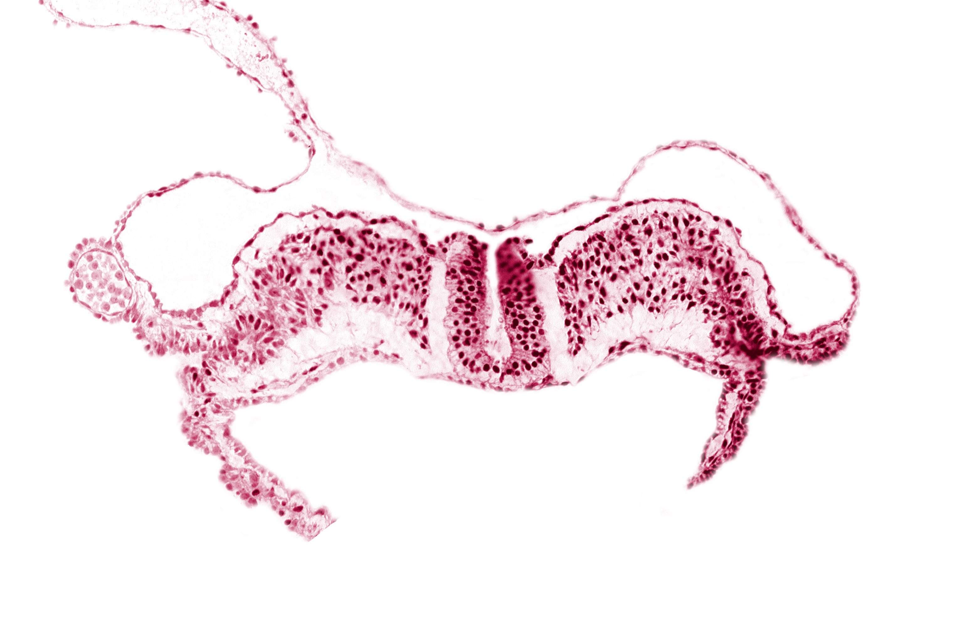 amniotic cavity, communication between primordial peritoneal cavity and extra-embryonic coelom, midgut, notochordal plate