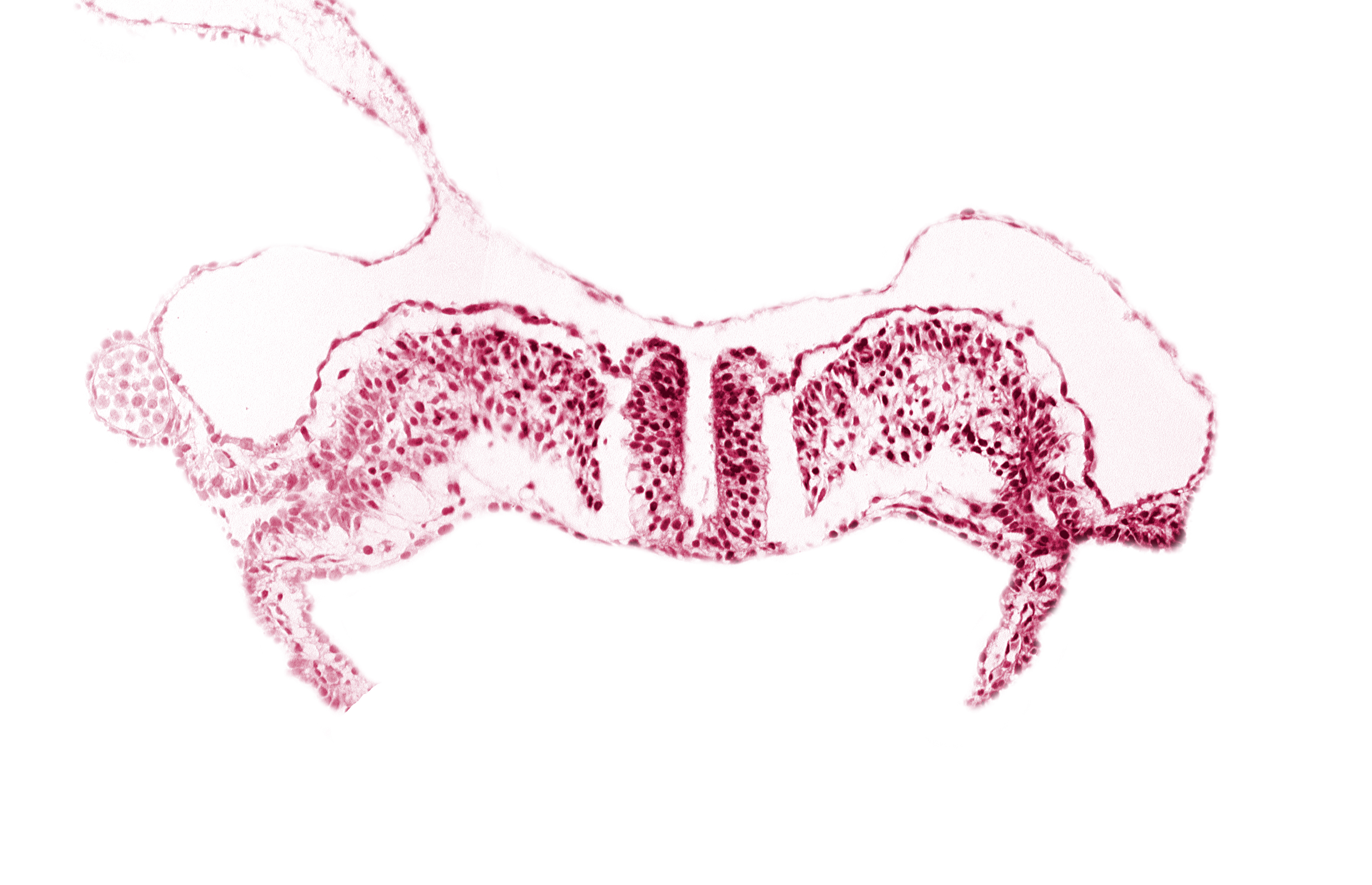 amniotic cavity, communication between primordial peritoneal cavity and extra-embryonic coelom, dorsal aorta plexus, midgut, notochordal plate