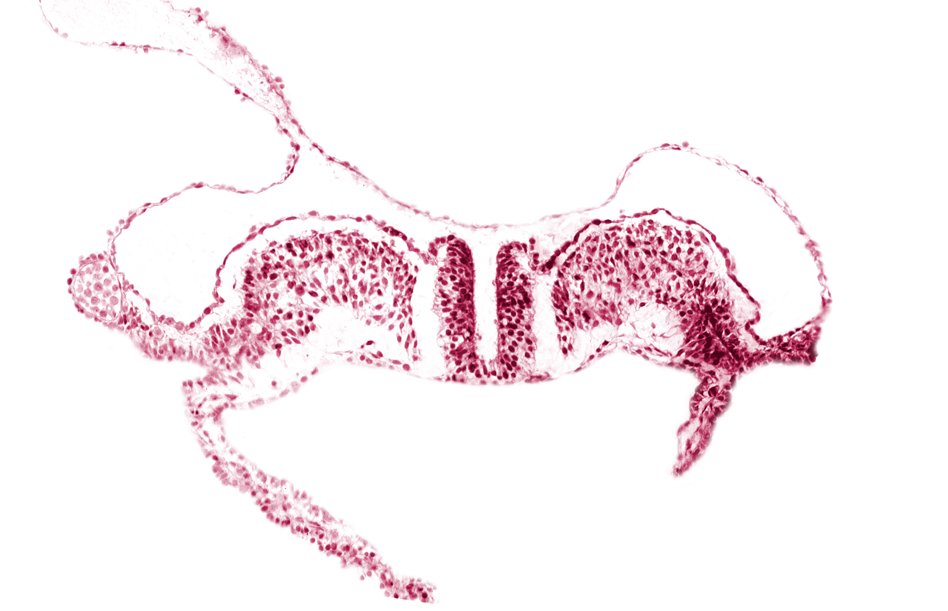 dorsal aorta plexus, notochordal plate, surface ectoderm
