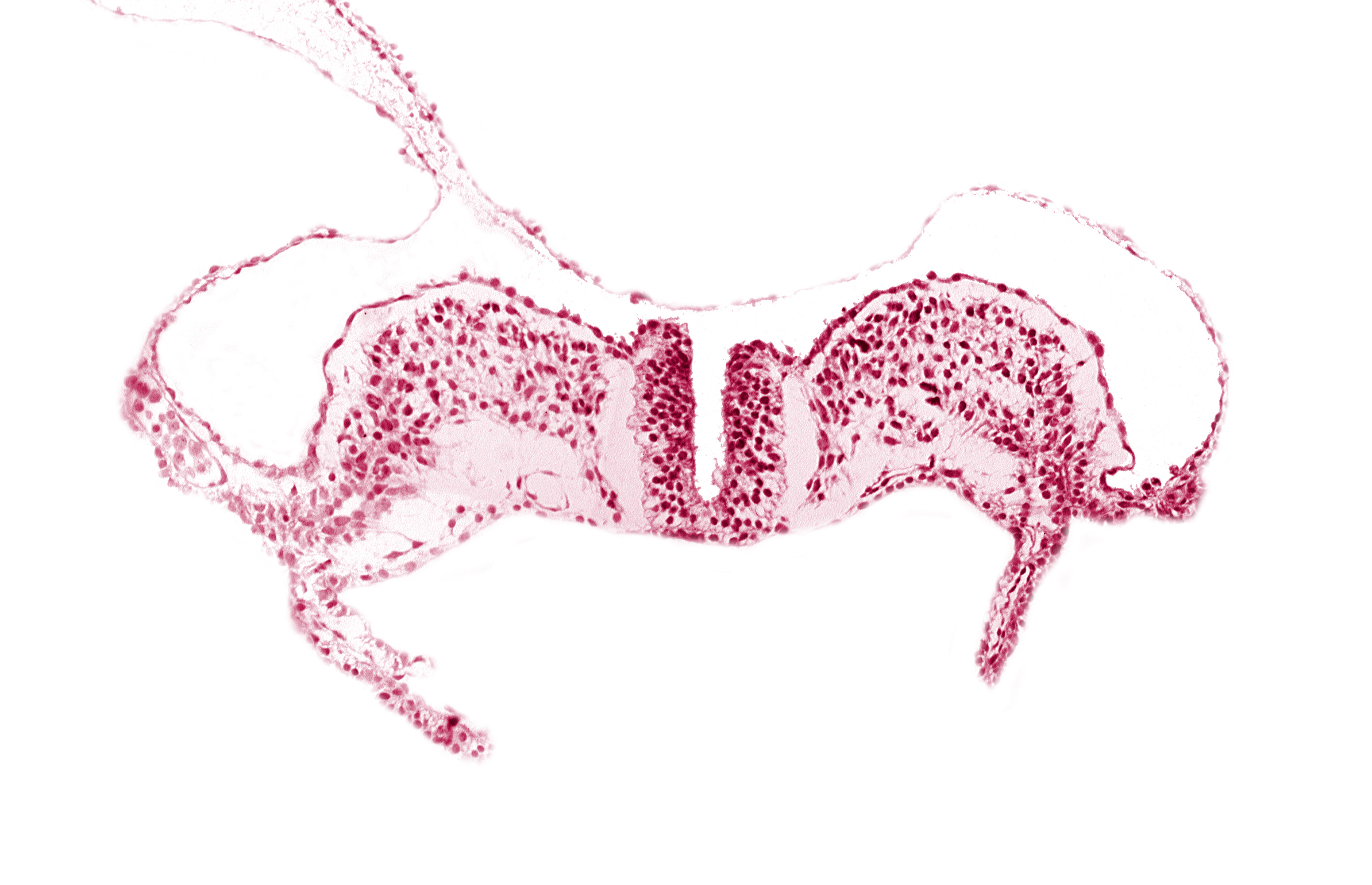 caudal neuropore, dorsal aorta plexus, midgut, primordial lateral body fold, surface ectoderm