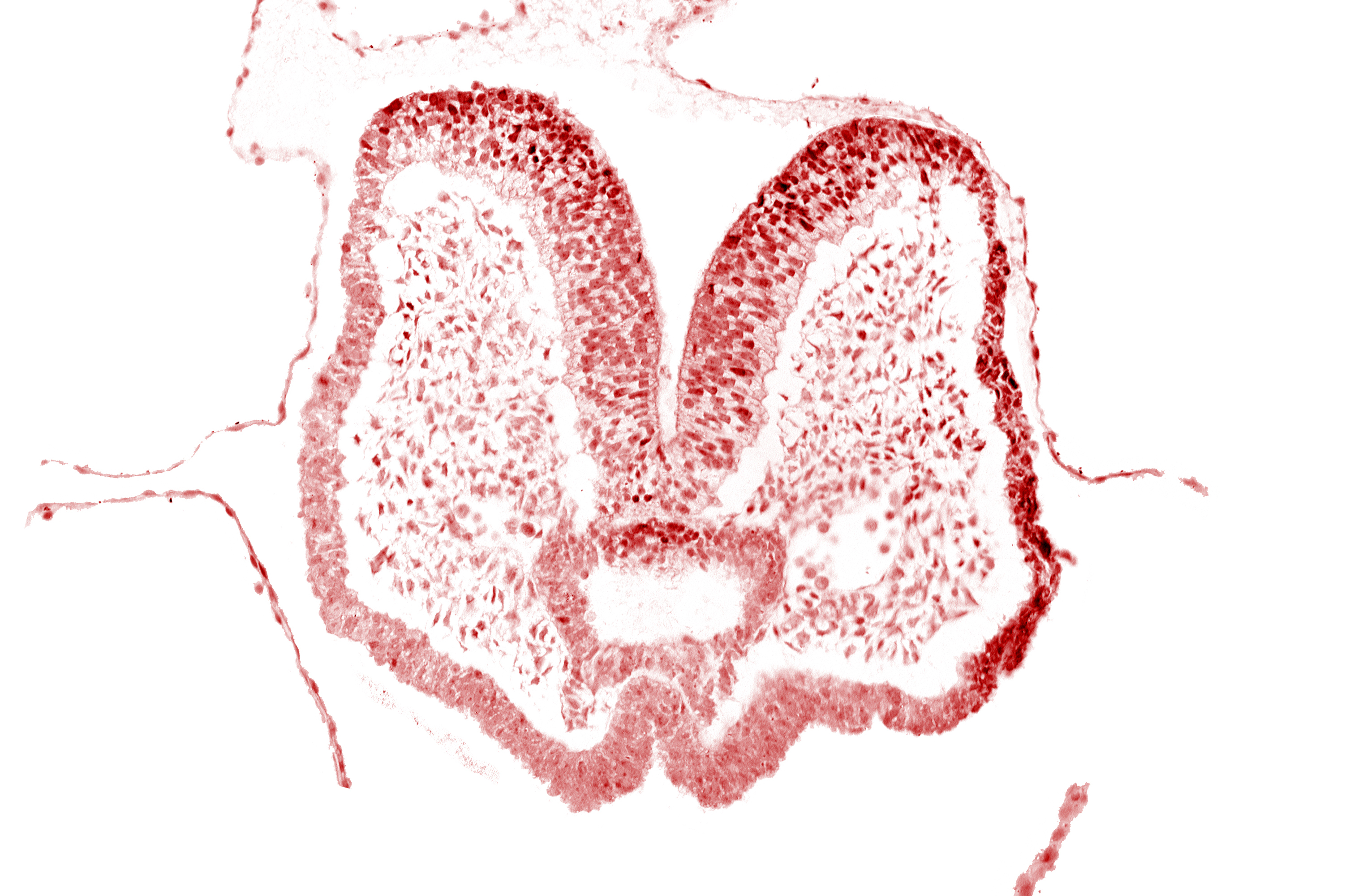 aortic arch 1, artifact space(s), cephalic neuropore, cephalic part of foregut, mandibular prominence of pharyngeal arch 1, mesencephalic neural crest, neural fold [mesencephalon (M)], neural groove (postoptic recess), notochordal plate, prechordal plate (oropharyngeal membrane), region of mesencephalic (cephalic) flexure, stomodeum, surface ectoderm