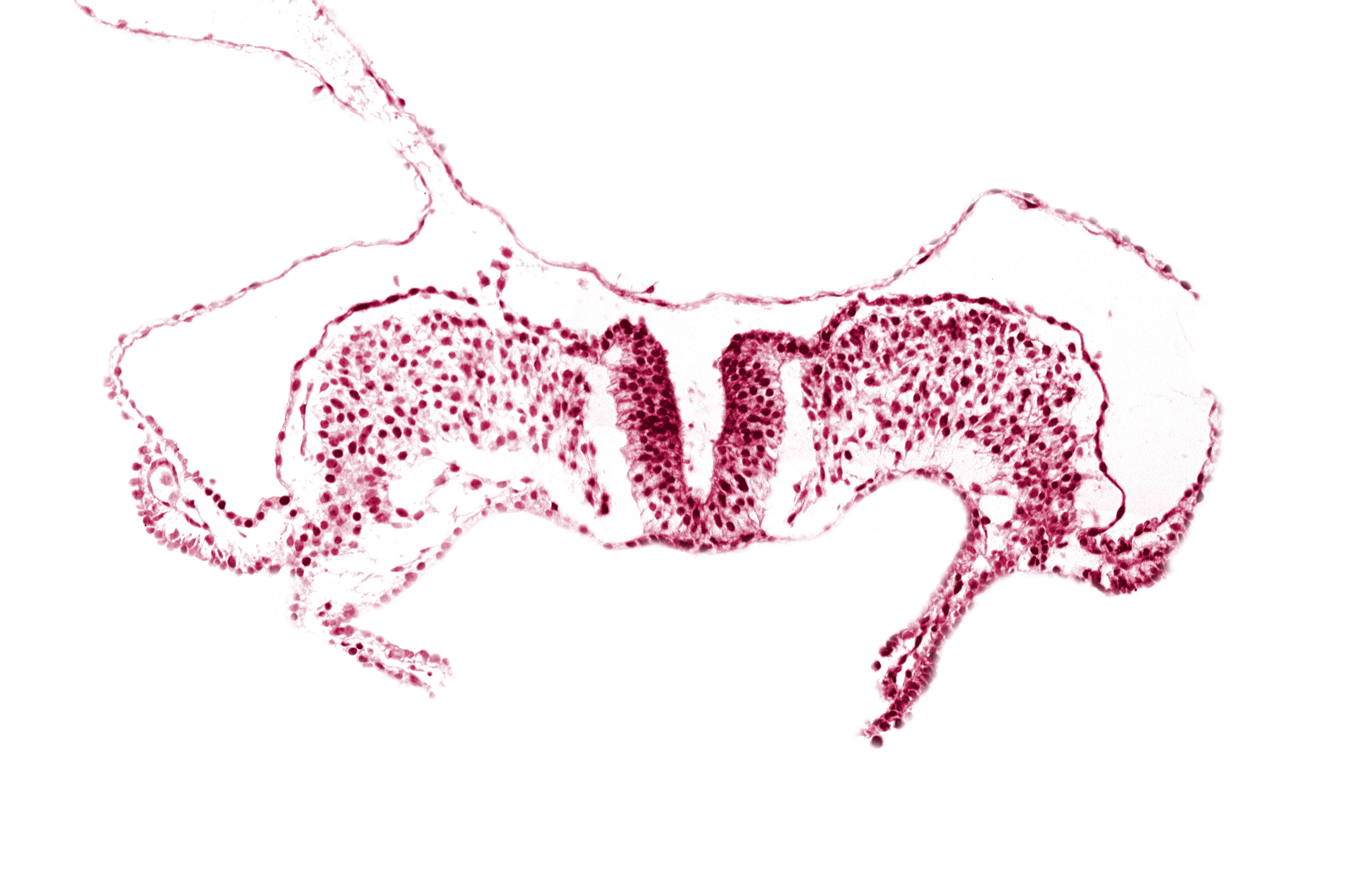 amnion attachment, amniotic cavity, midgut, primordial lateral body fold, umbilical vesicle cavity