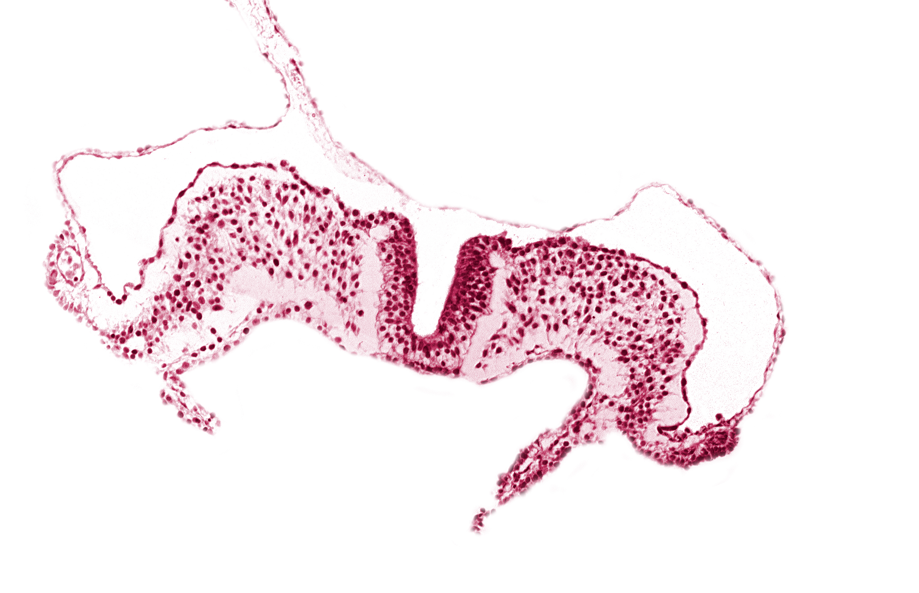 amnion attachment, amniotic cavity, caudal neuropore, primordial lateral body fold, umbilical vesicle cavity