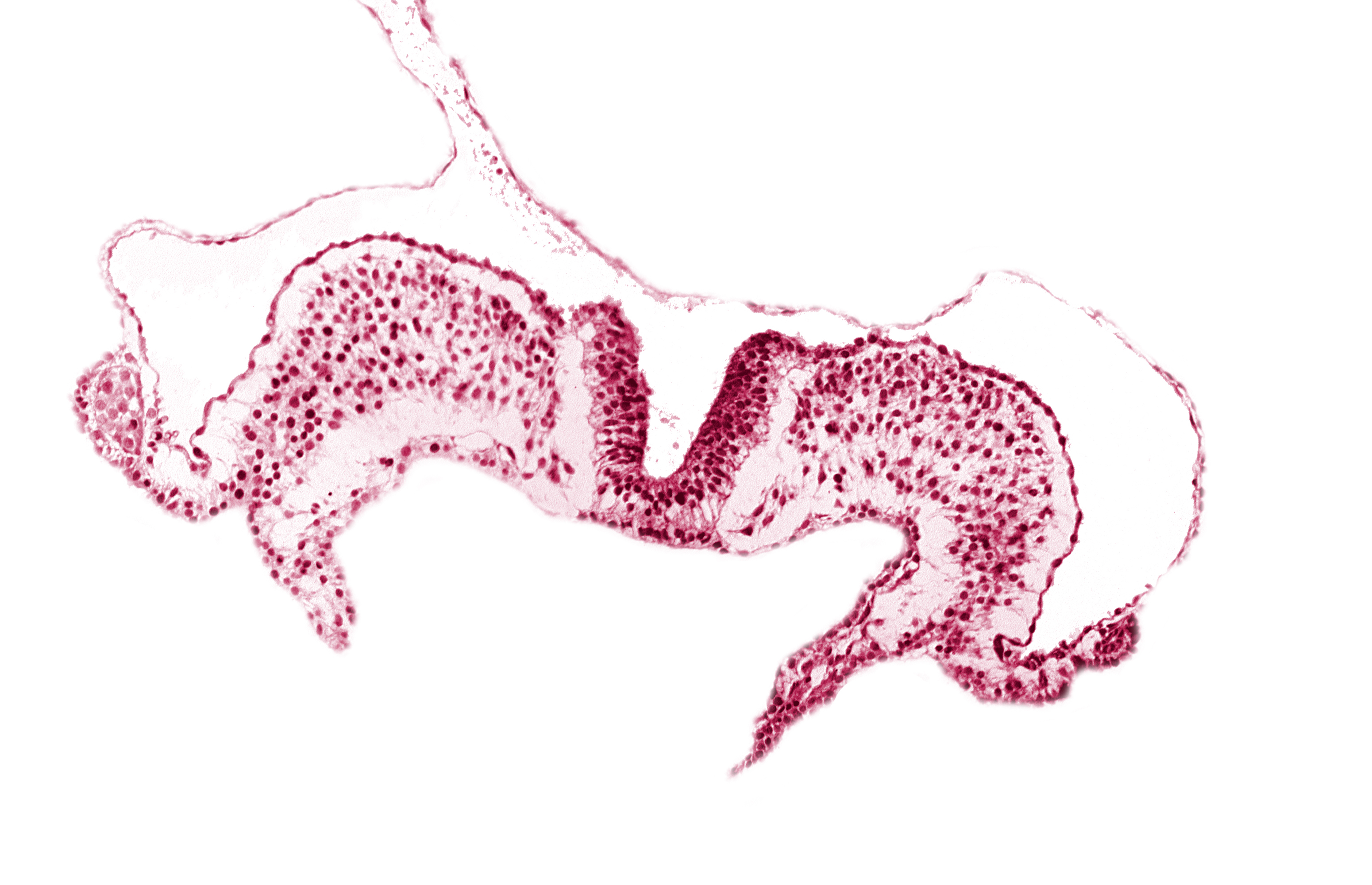 amniotic cavity, caudal neuropore, primordial lateral body fold