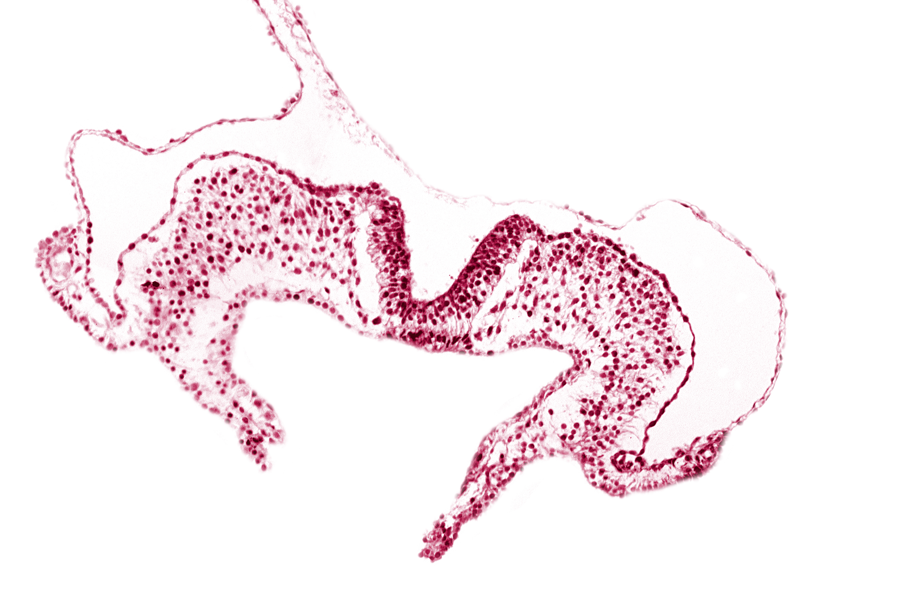 caudal neuropore, midgut, notochordal plate, primordial lateral body fold, surface ectoderm