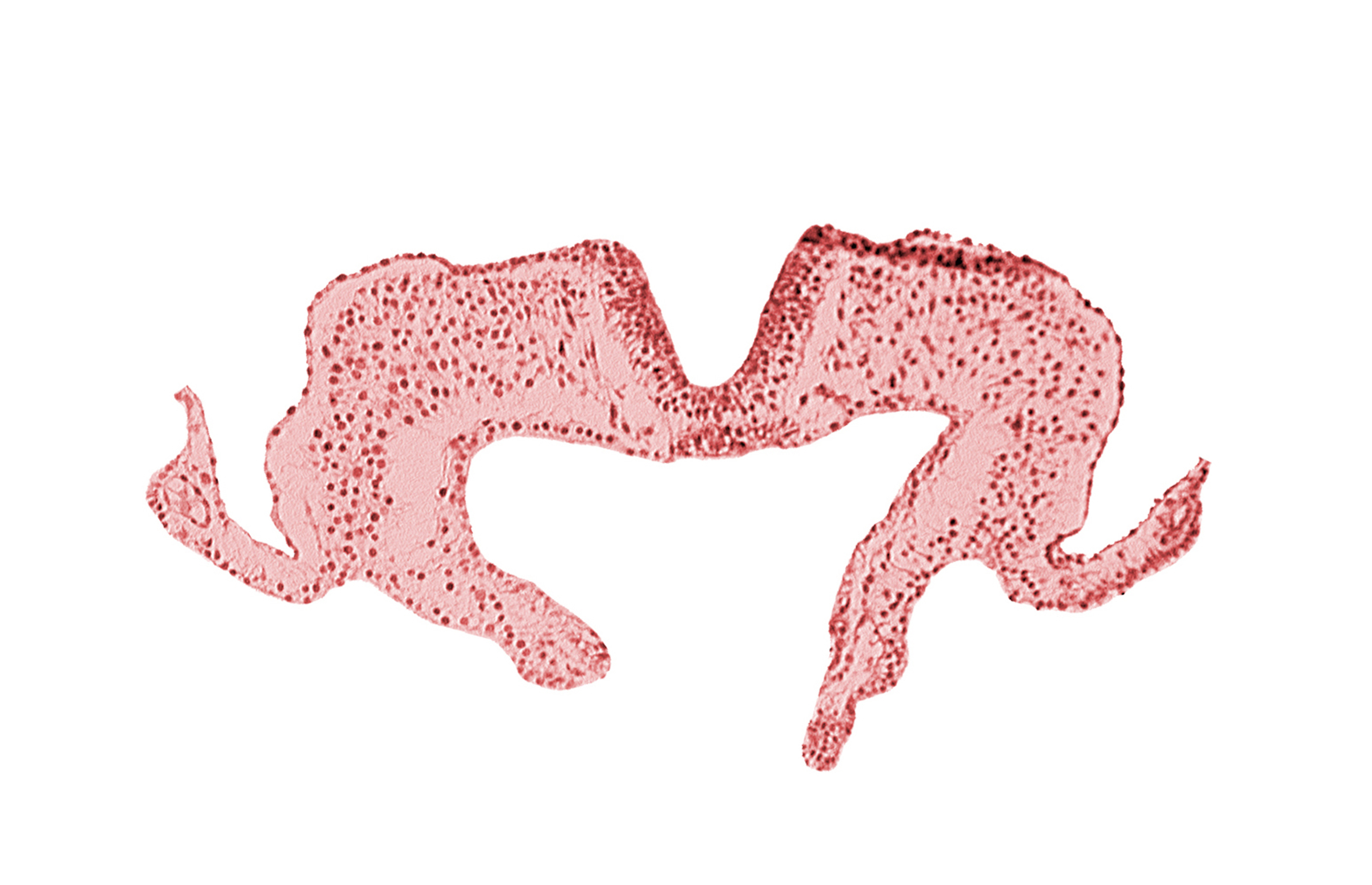endoderm, mesoderm, midgut, neural fold, neural groove, notochordal plate, primordial lateral body fold, surface ectoderm