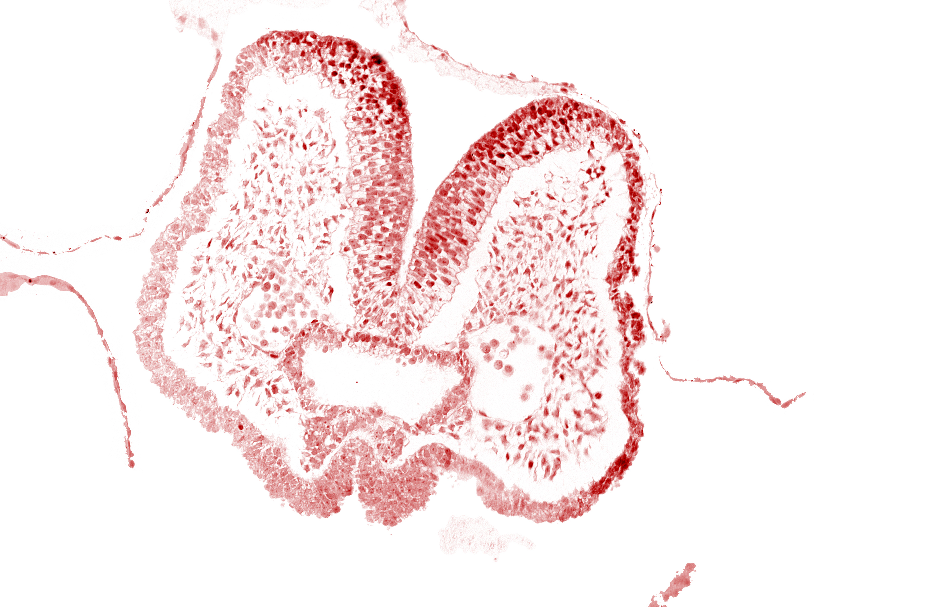 aortic arch 1, artifact space(s), endoderm, foregut, mandibular prominence of pharyngeal arch 1, mesencephalic neural crest, mesenchyme in pharyngeal arch 1, neural fold [mesencephalon (M)], neural groove, notochordal plate, prechordal plate (oropharyngeal membrane), stomodeum, surface ectoderm