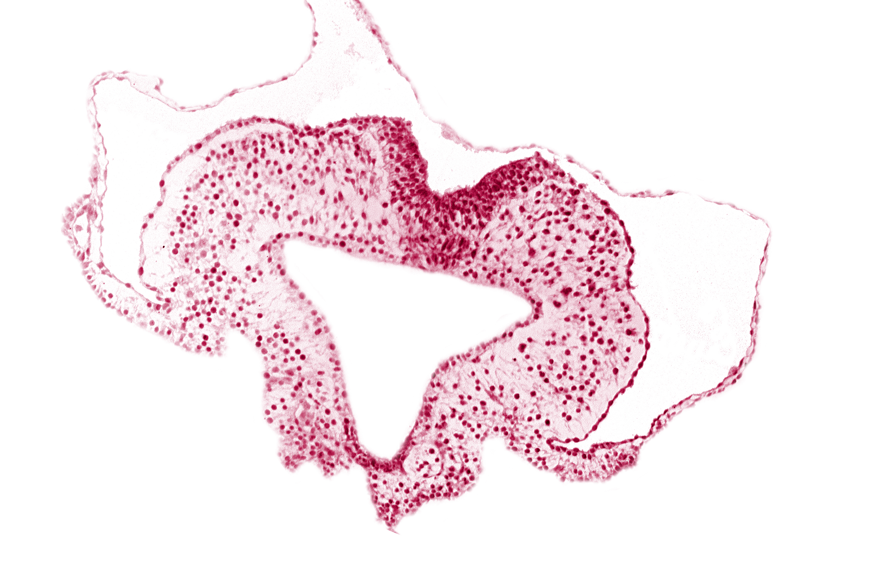 caudal intestinal portal, endoderm, transition region between notochordal plate and gastrulation streak