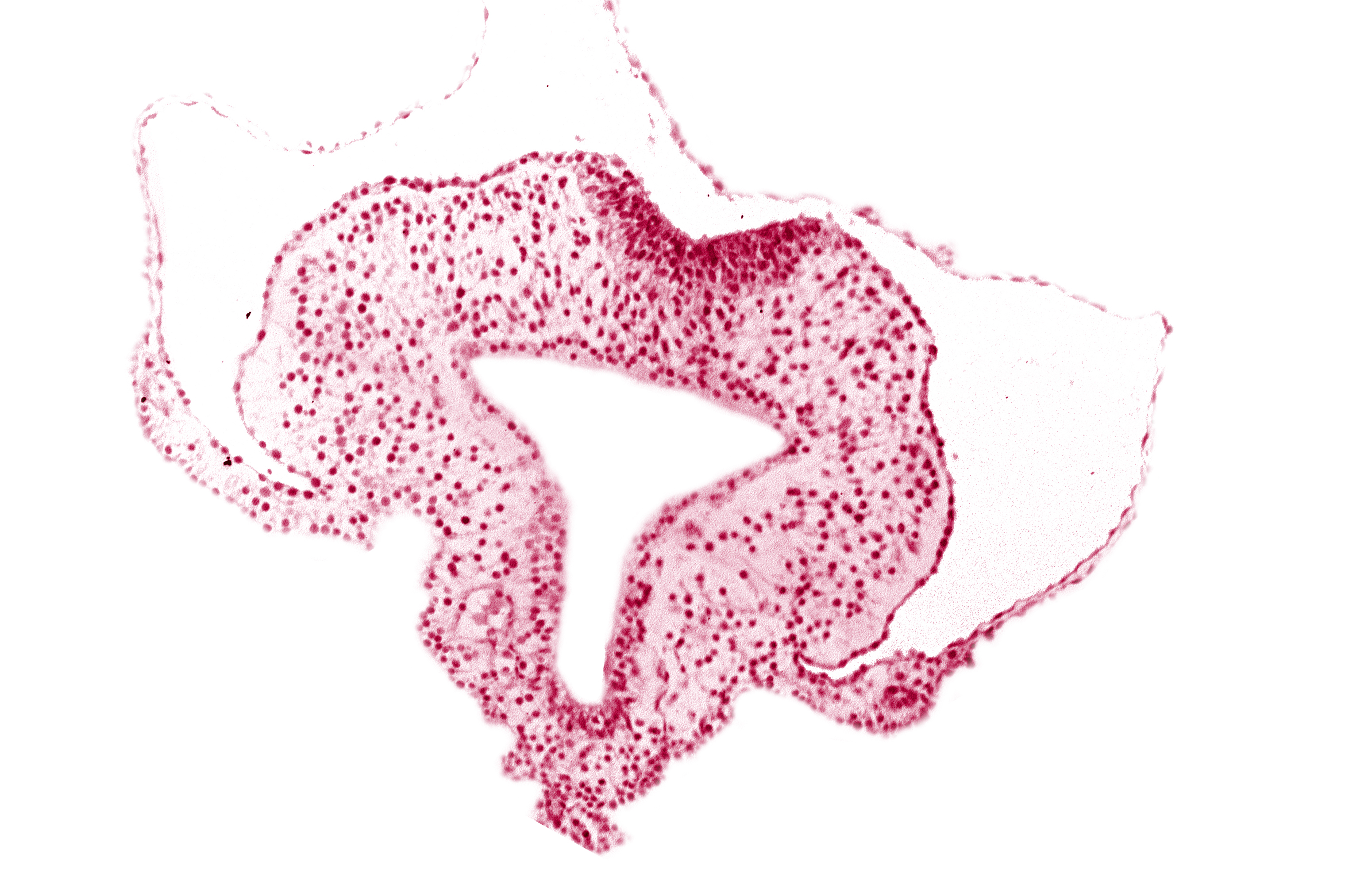 allantoic primordium, amnion attachment, amniotic cavity, extra-embryonic coelom, gastrulation (primitive) streak, hindgut, left umbilical vein, neural plate, primordial lateral body fold