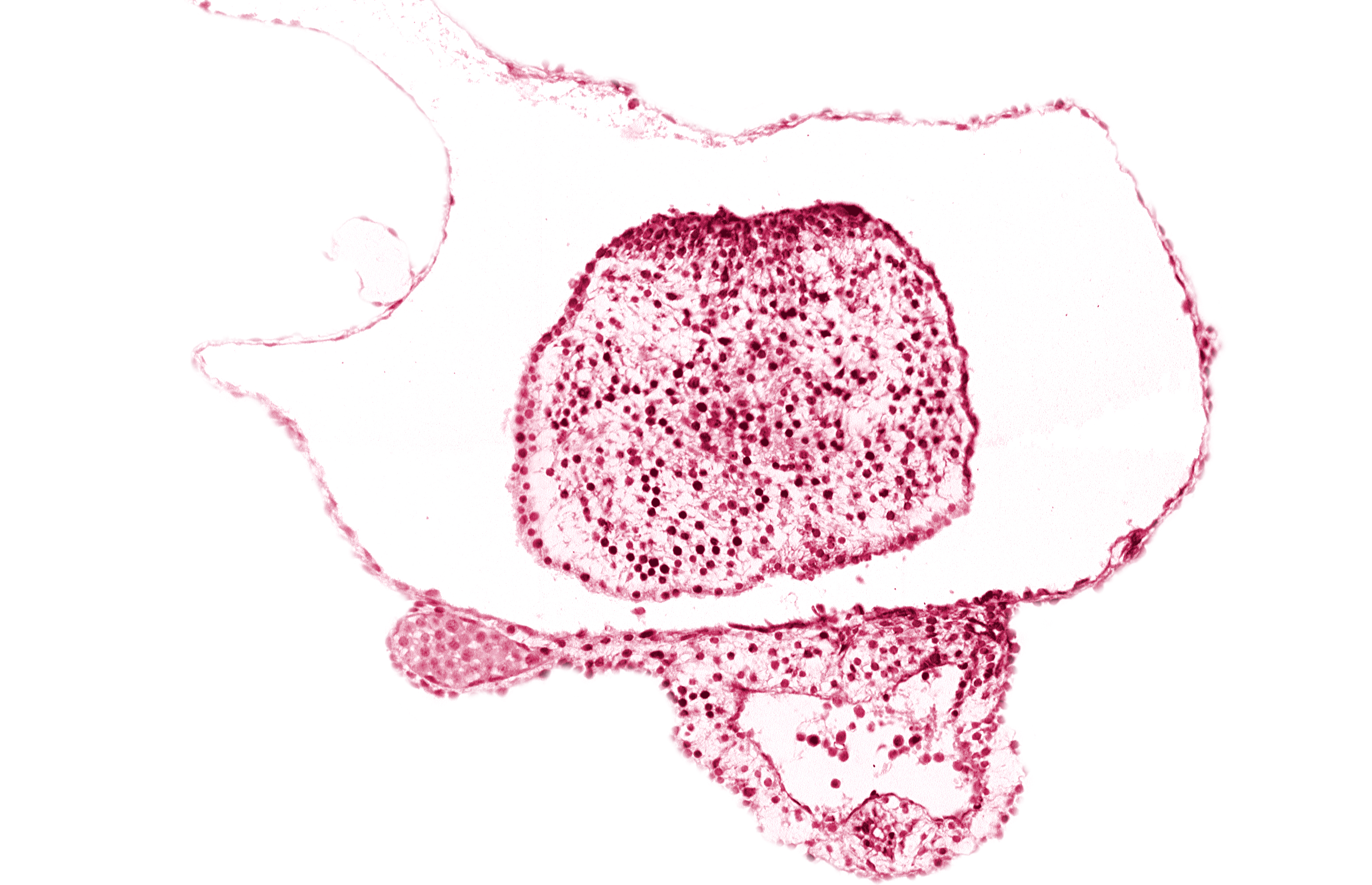 caudal eminence, gastrulation (primitive) streak, neural plate