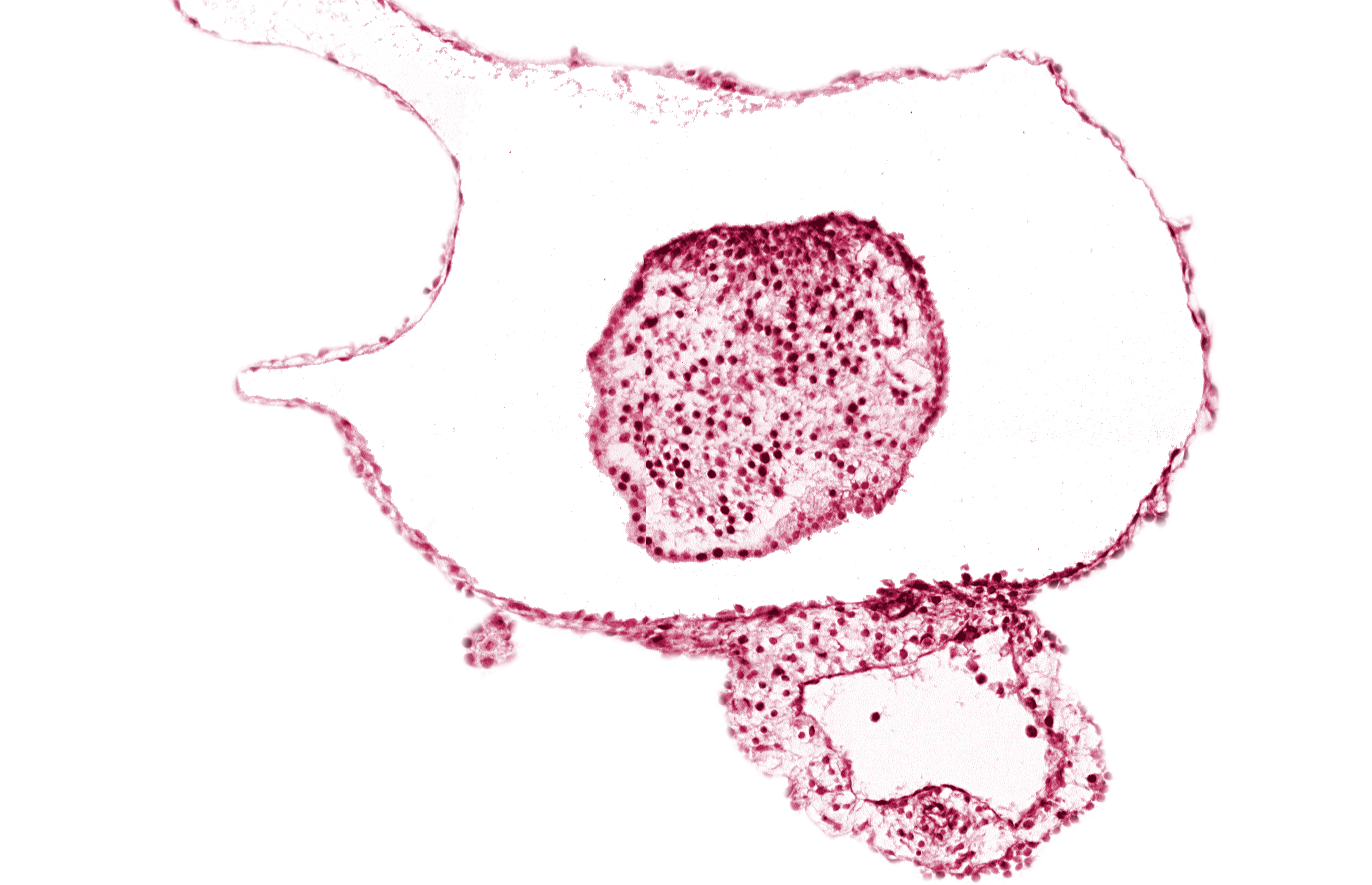 caudal eminence, caudal part of neural cord