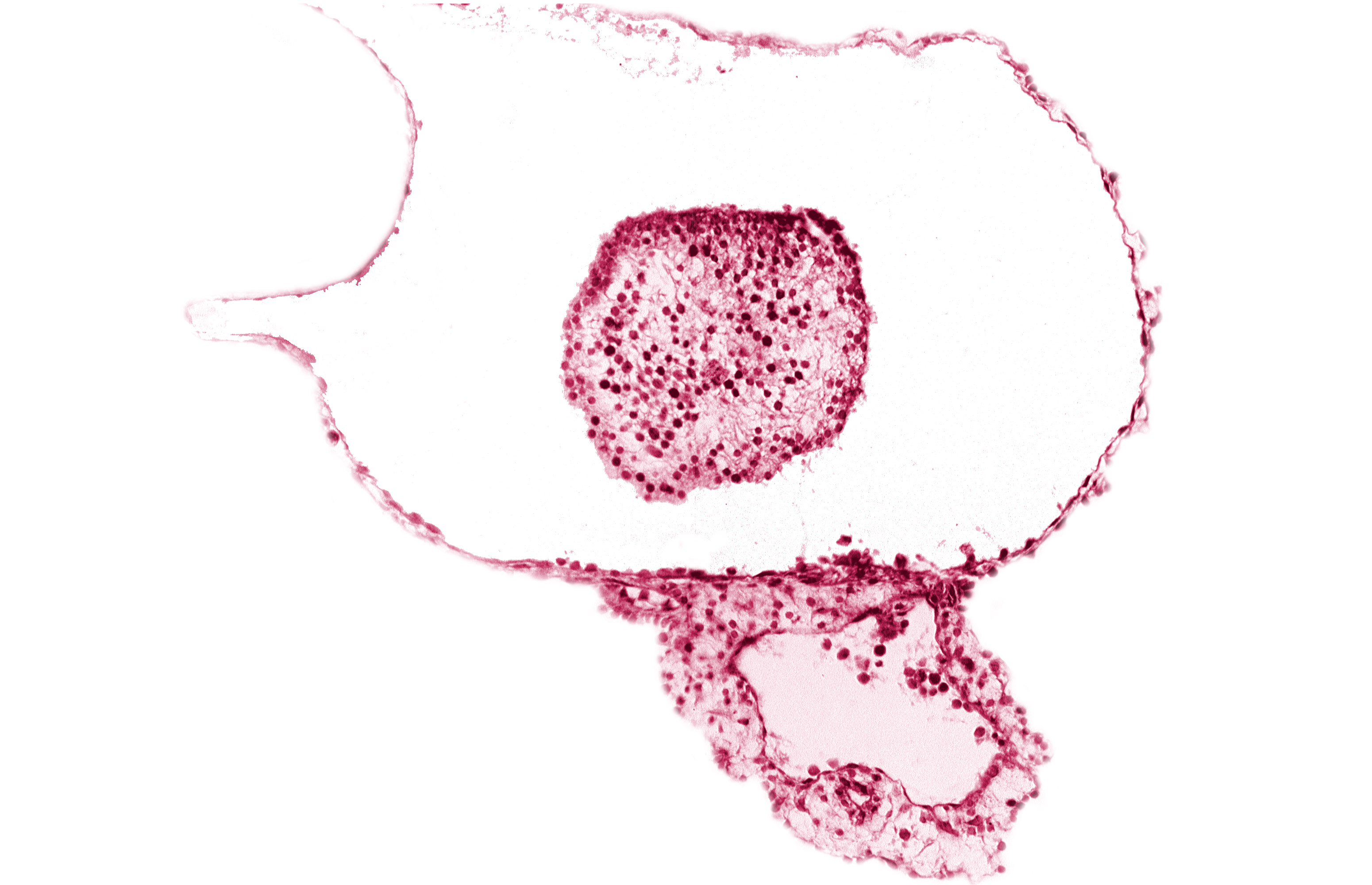 caudal part of caudal eminence, caudal part of neural cord